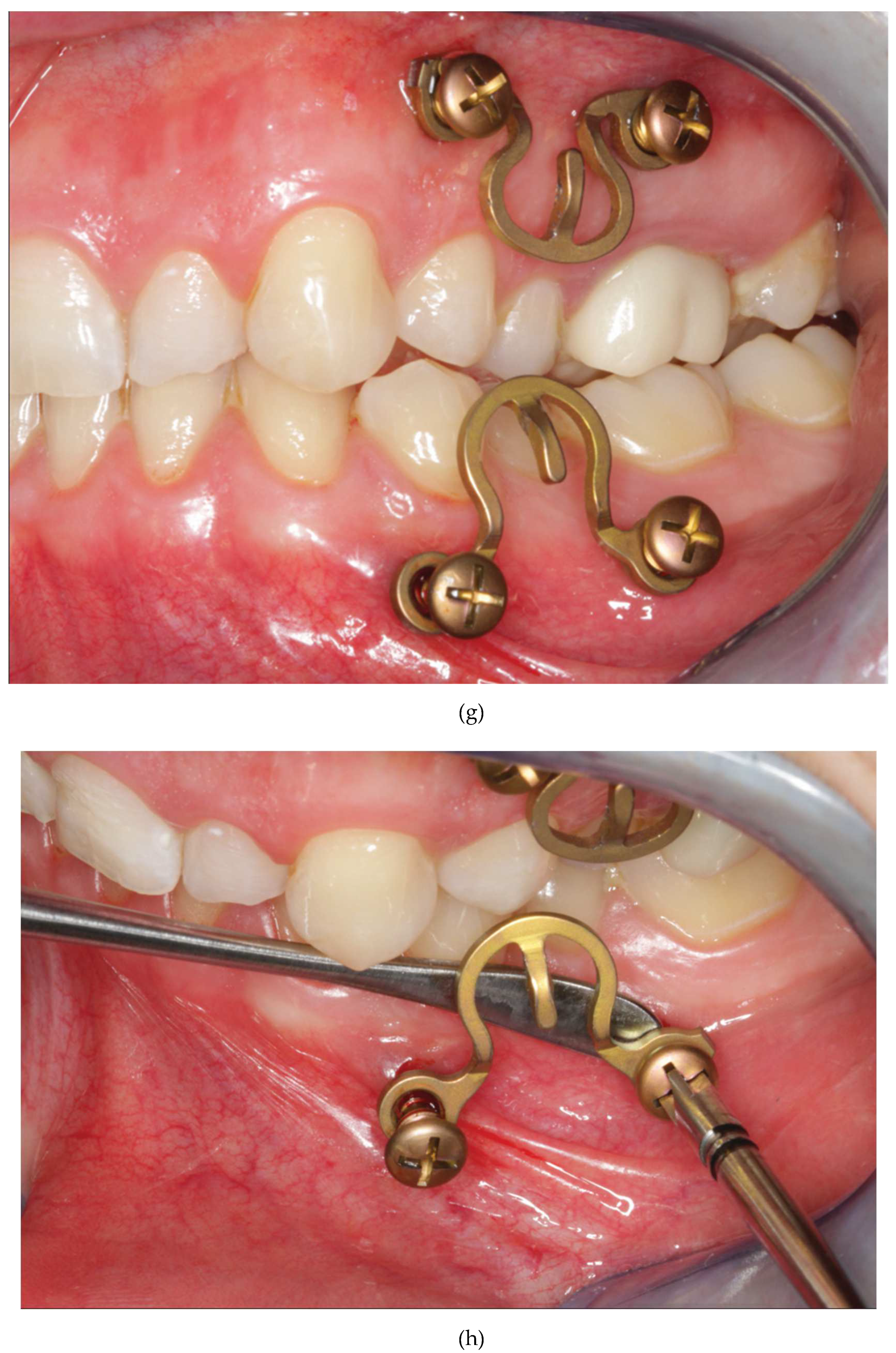 Preprints 150638 g015d