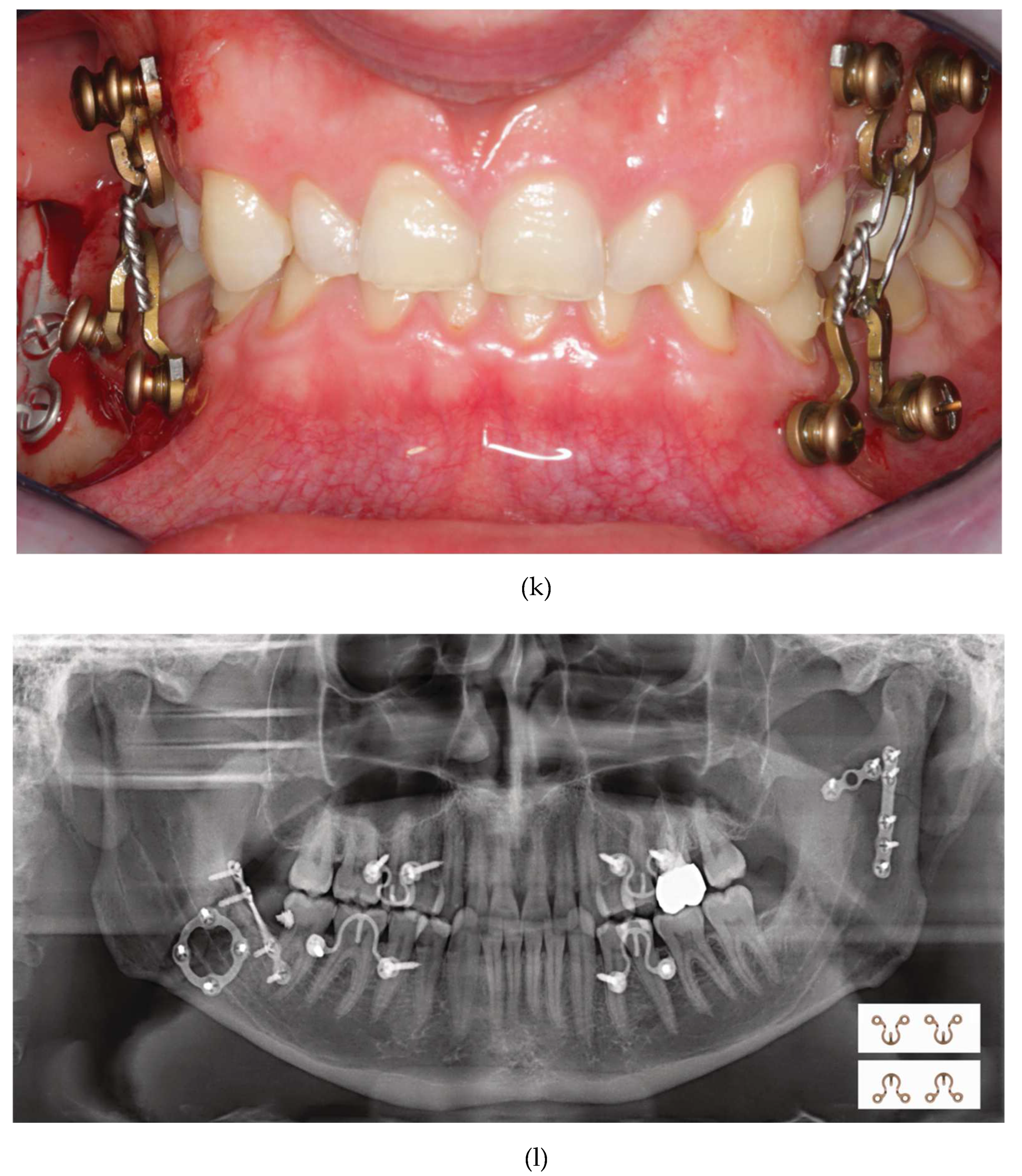 Preprints 150638 g015f
