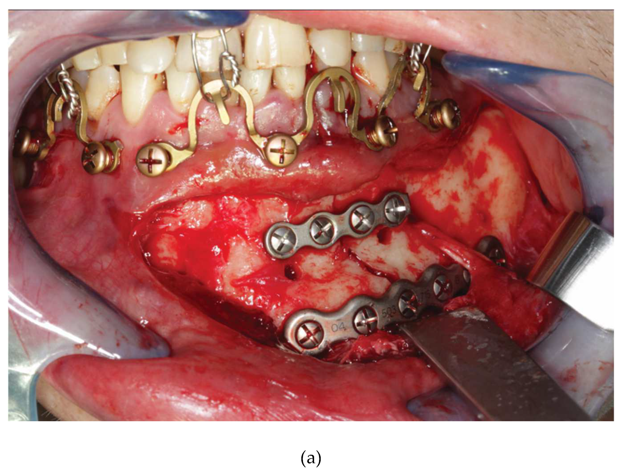 Preprints 150638 g016a