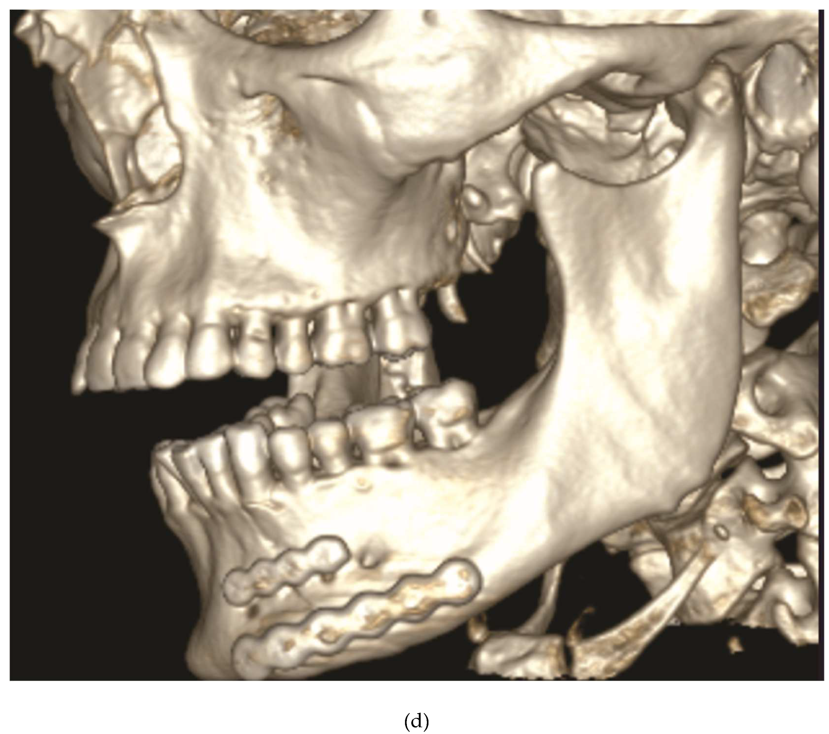 Preprints 150638 g016c