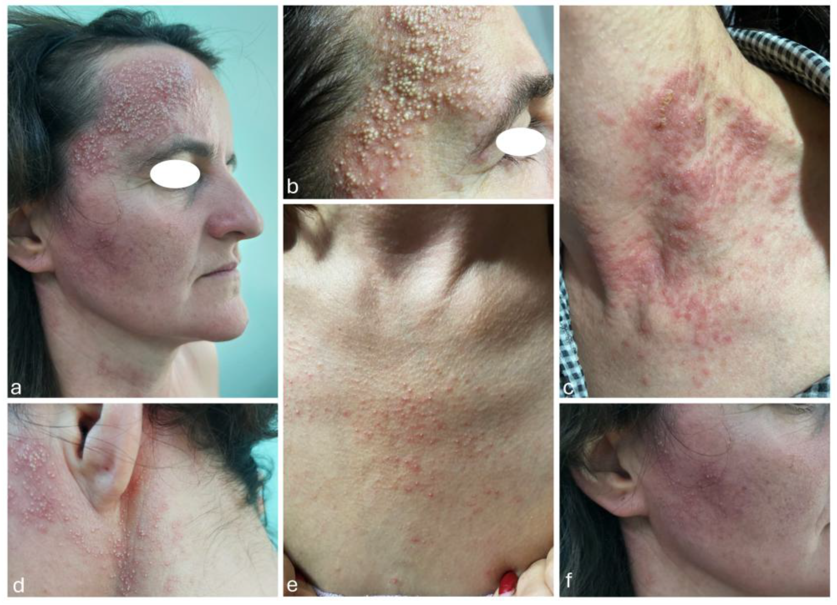 Preprints 148177 g001