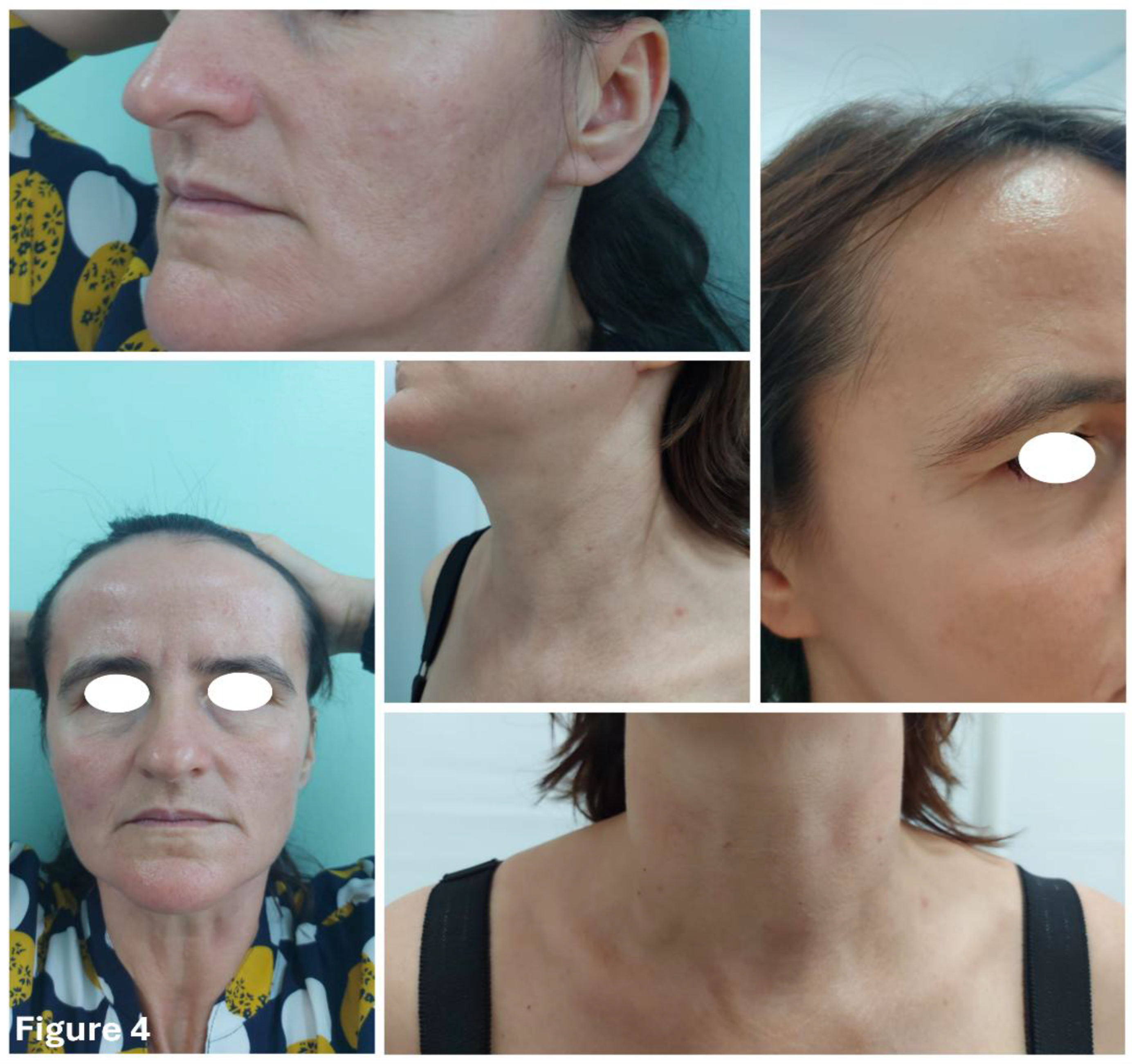 Preprints 148177 g004