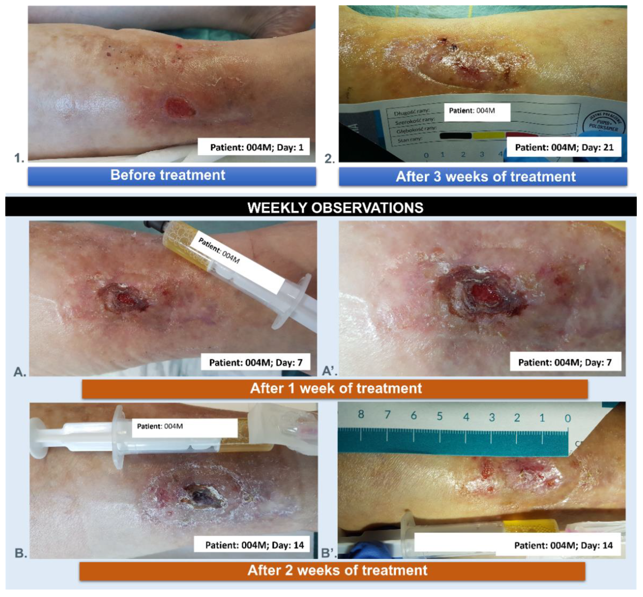 Preprints 138543 g014