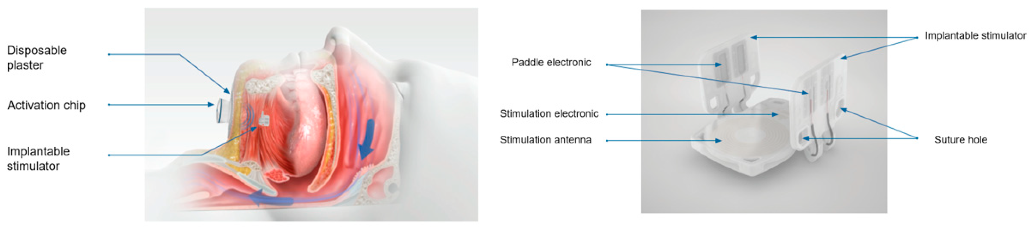 Preprints 164026 g001