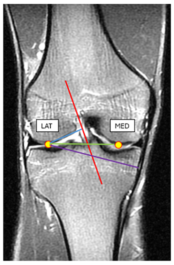 Preprints 177583 i001