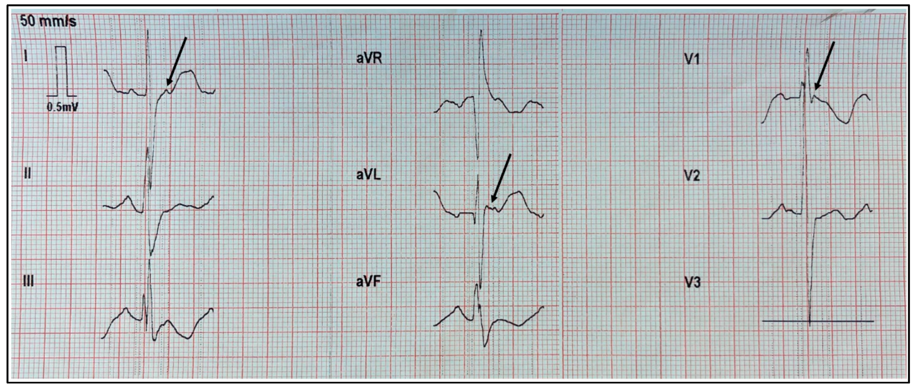 Preprints 103892 g001