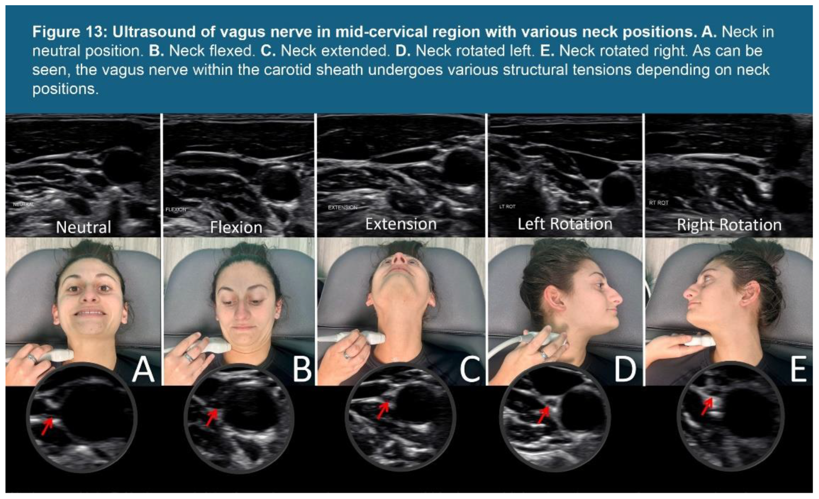 Preprints 156081 g013