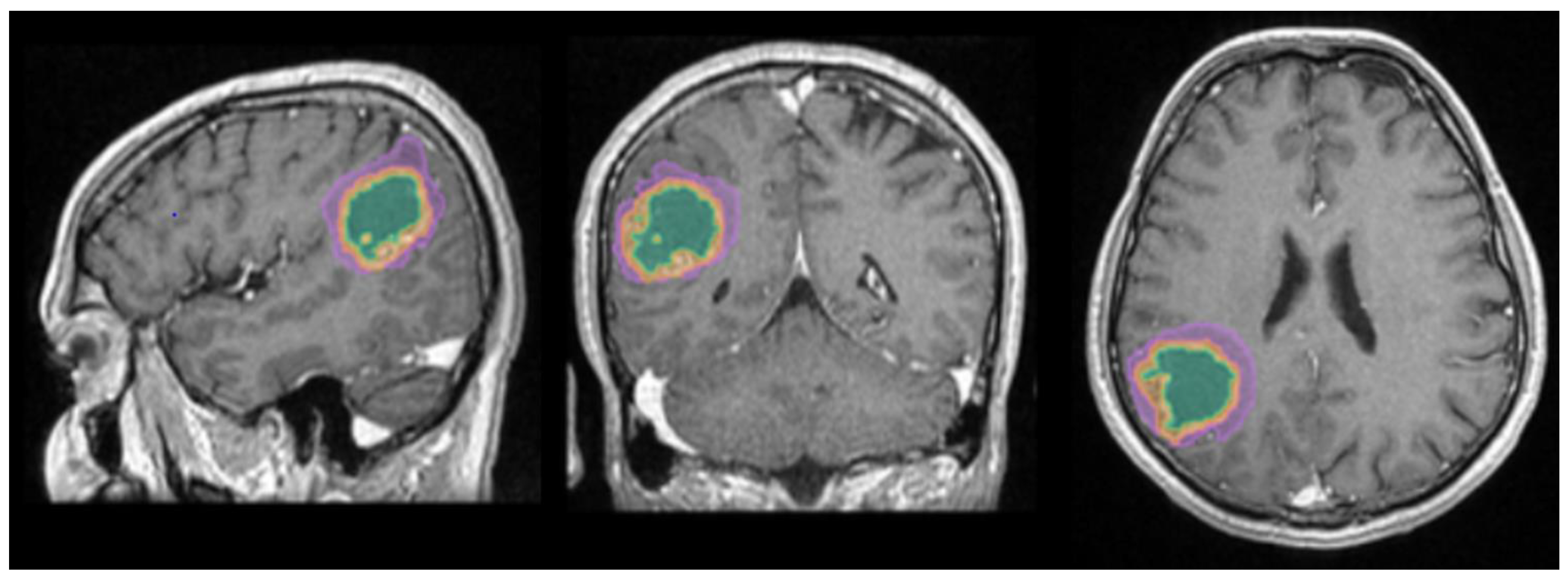 Preprints 171616 g001