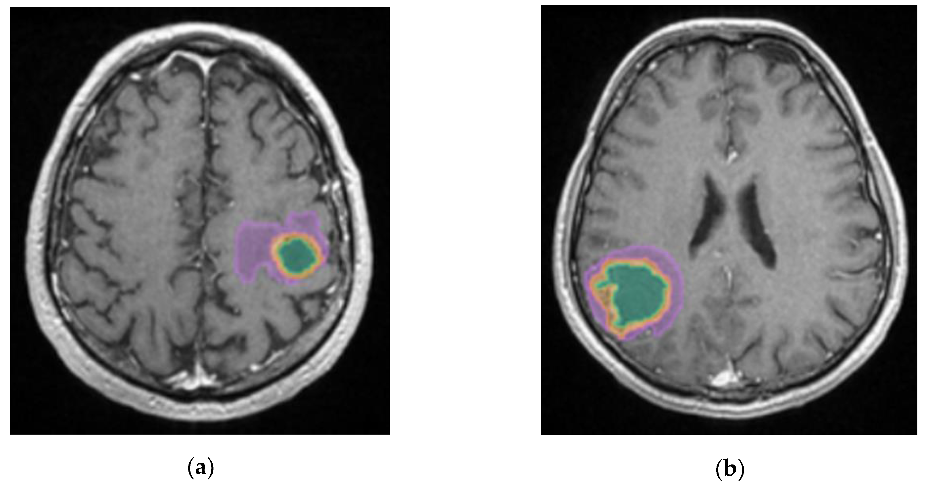 Preprints 171616 g010