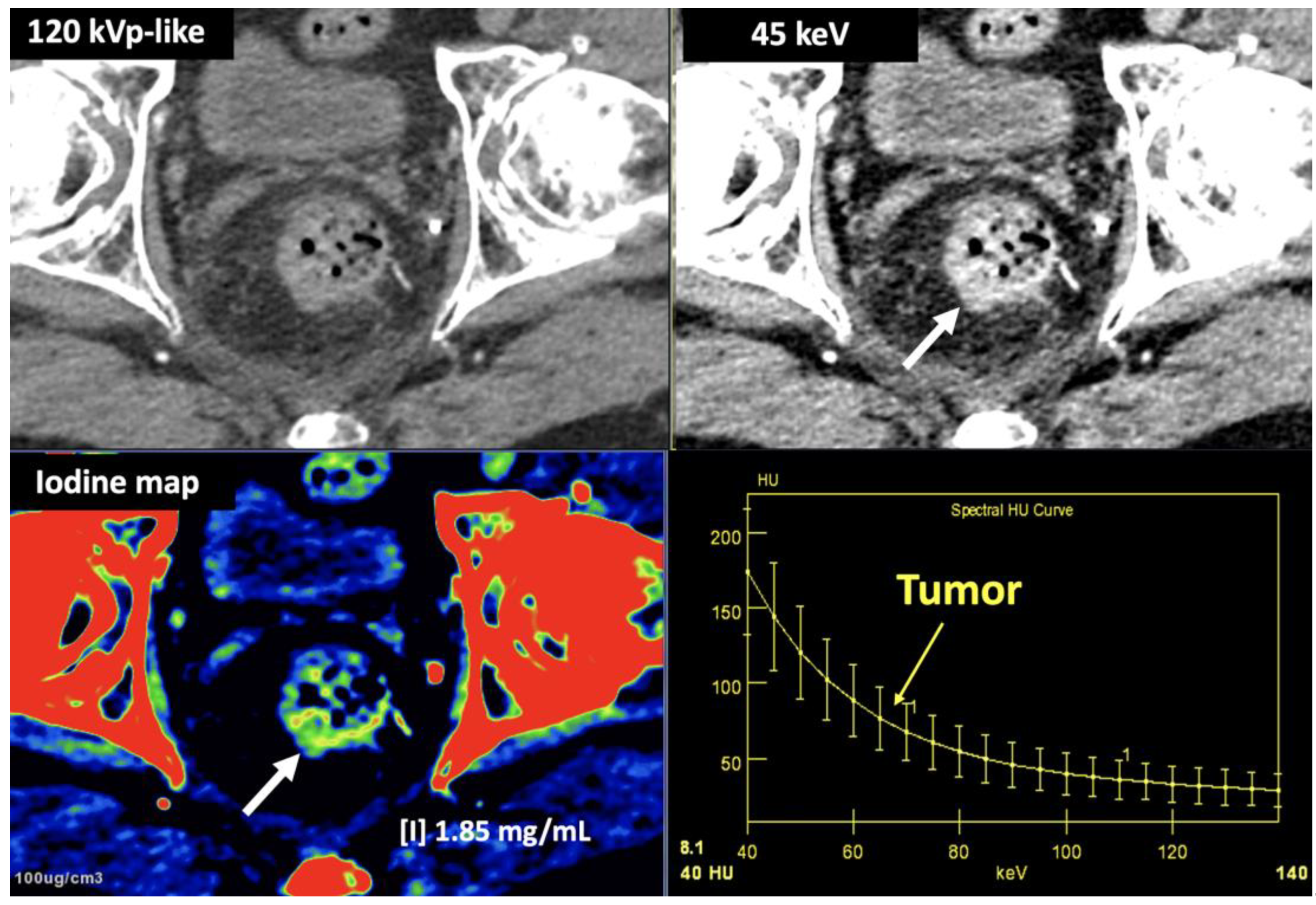Preprints 107240 g018b