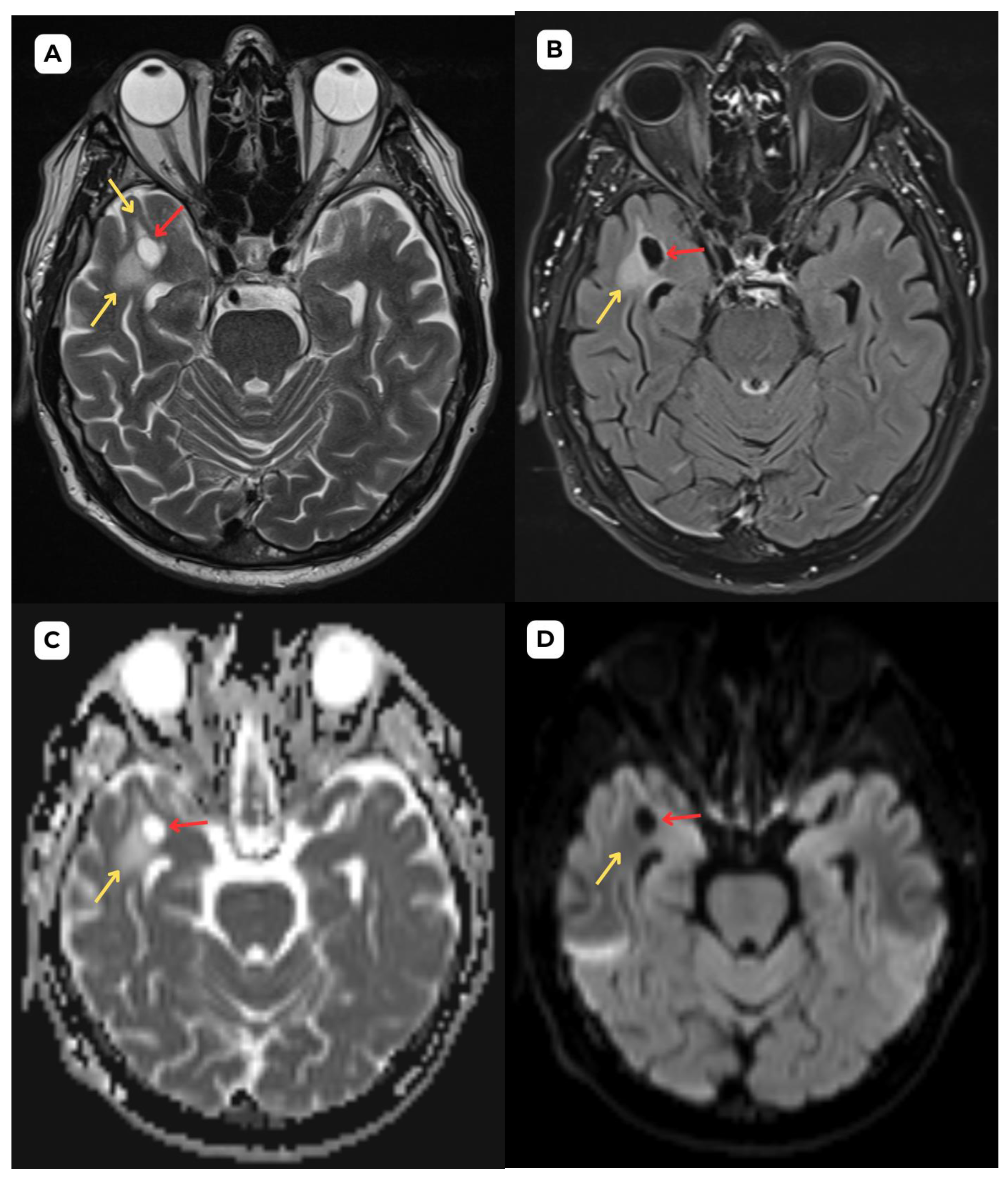 Preprints 161957 g001