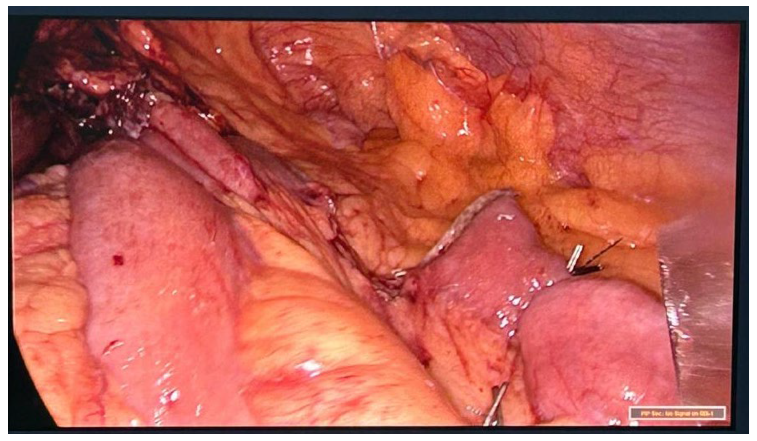 Preprints 115888 g003