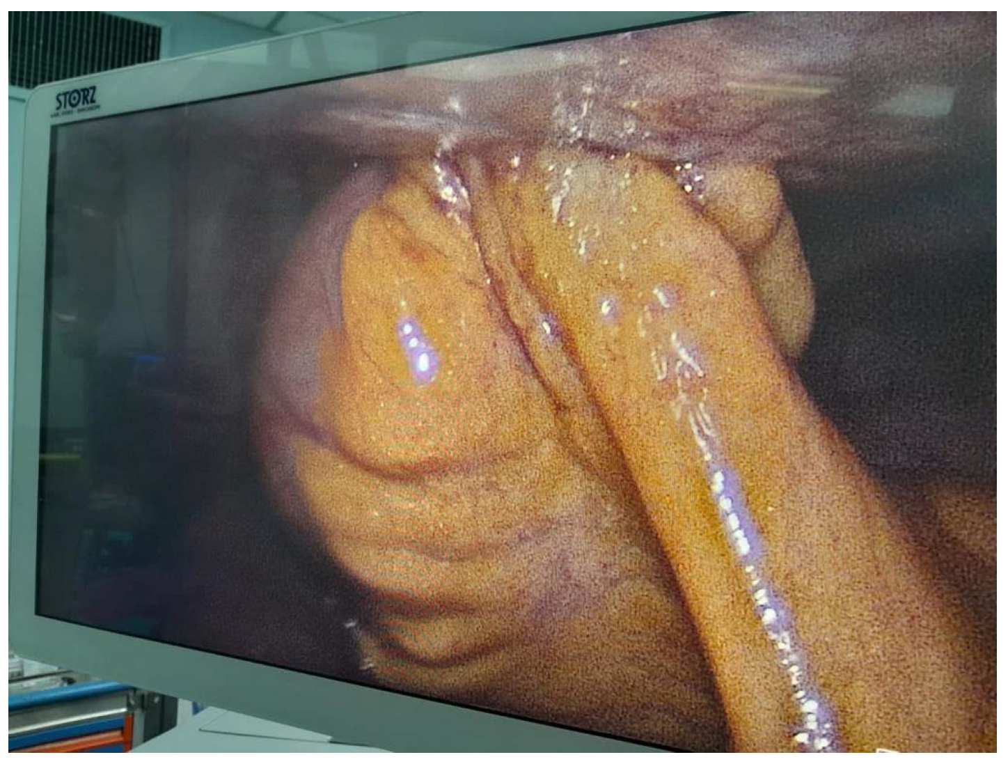 Preprints 115888 g006