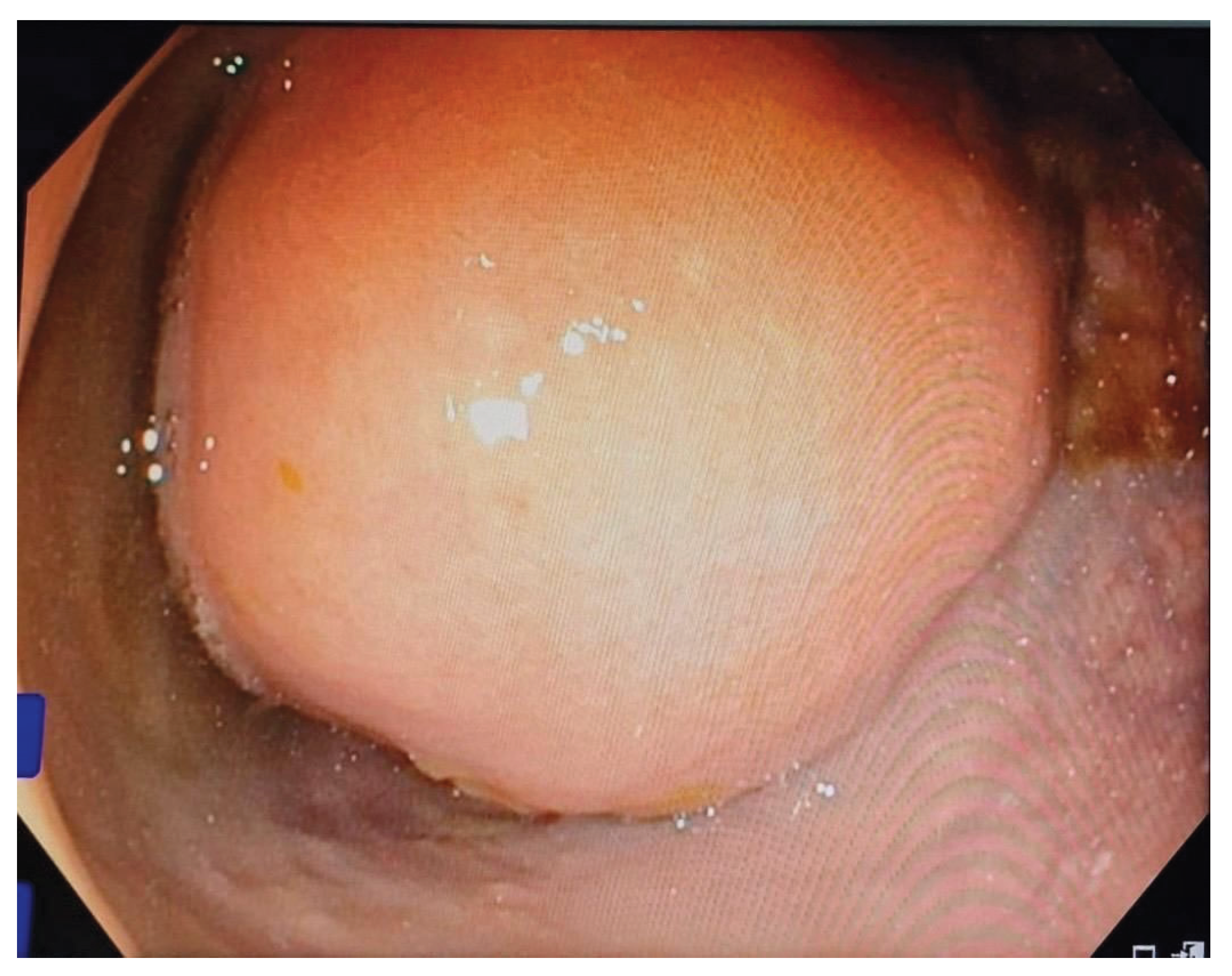 Preprints 184025 g002