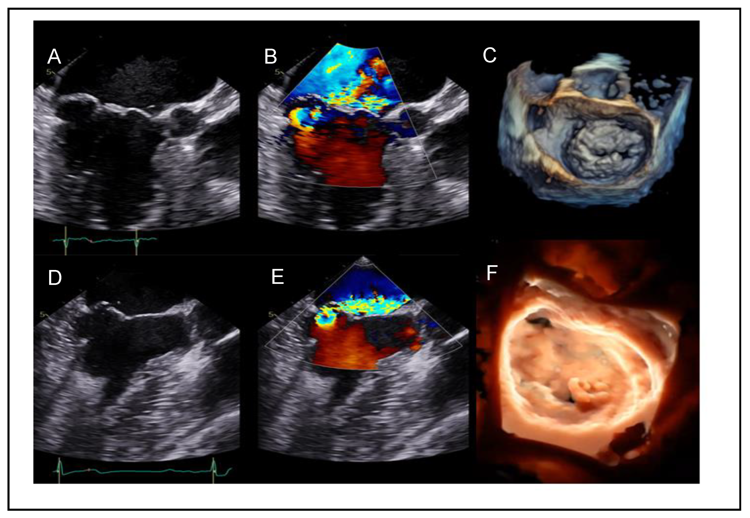 Preprints 161389 g001