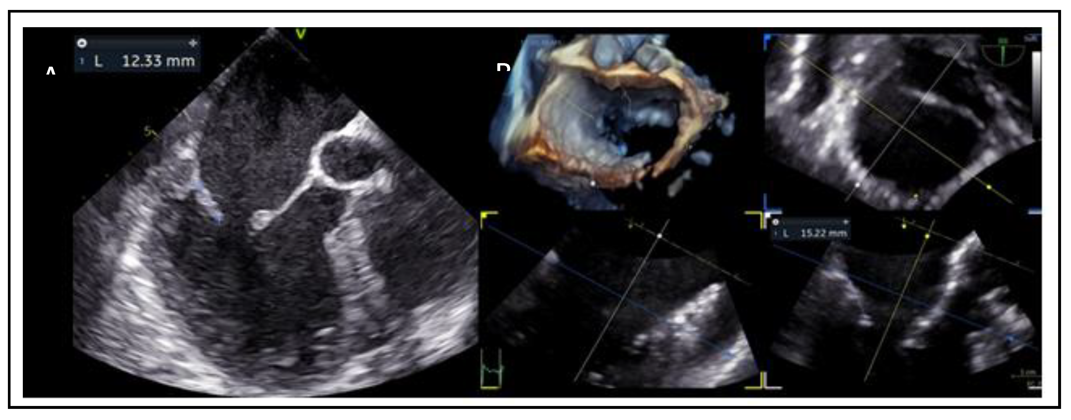 Preprints 161389 g005