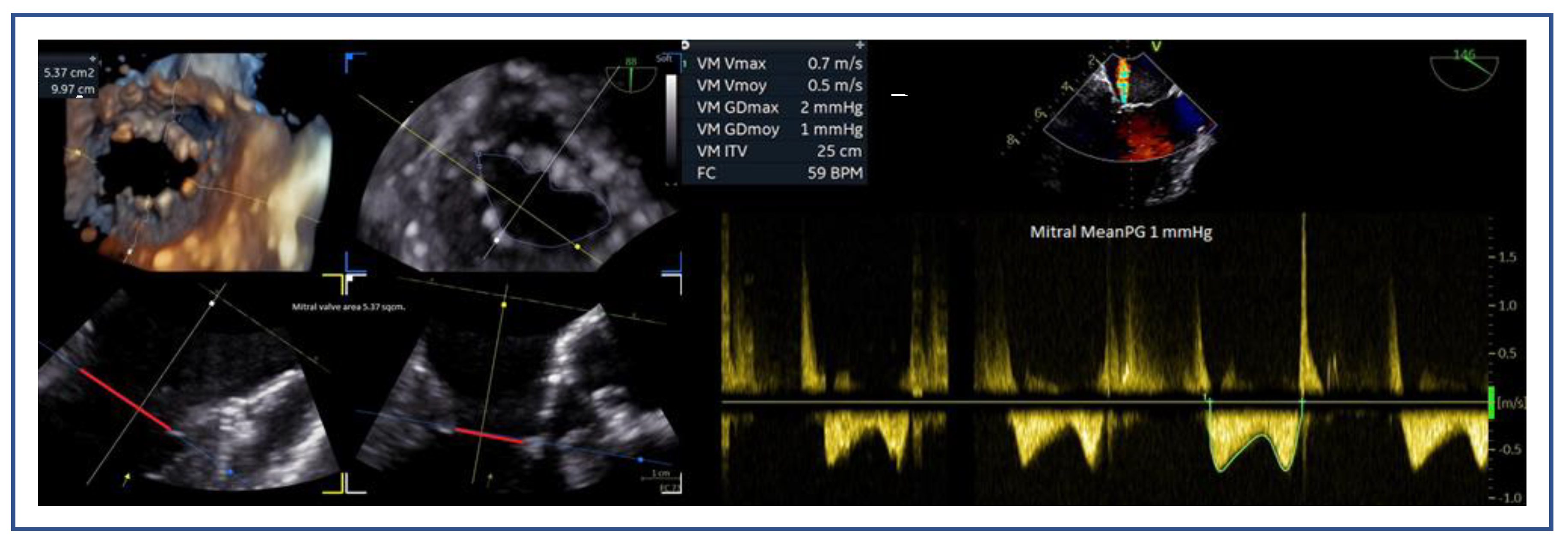 Preprints 161389 g006