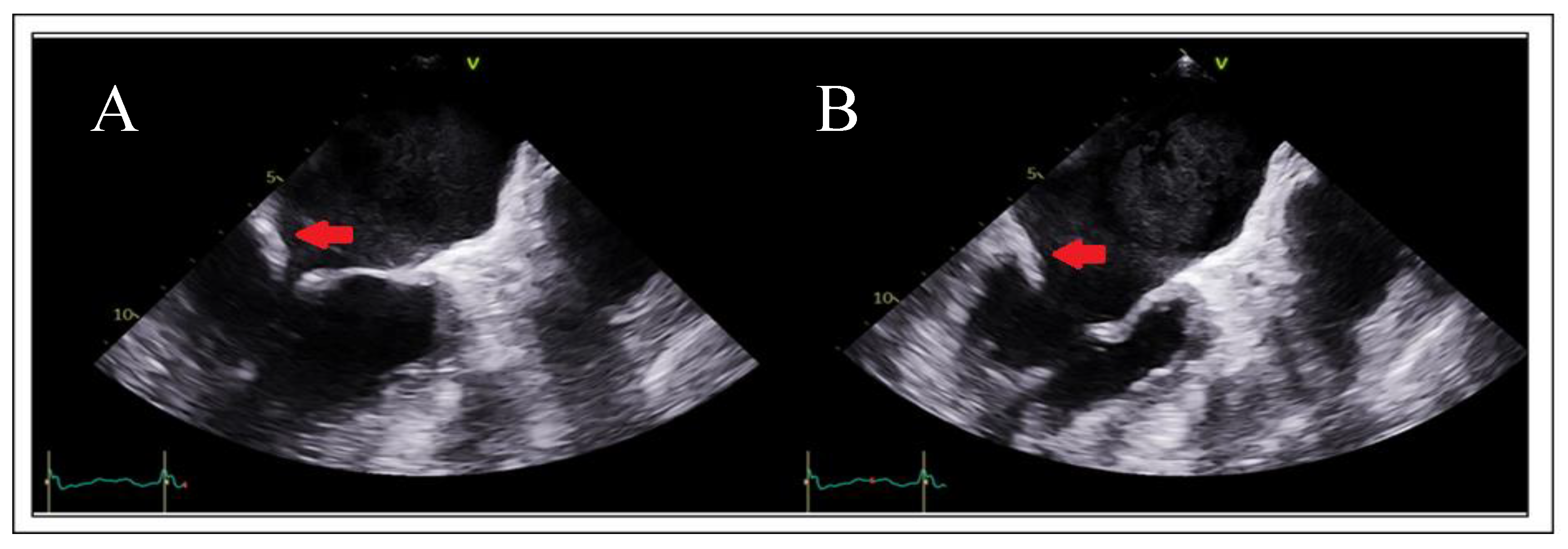 Preprints 161389 g011