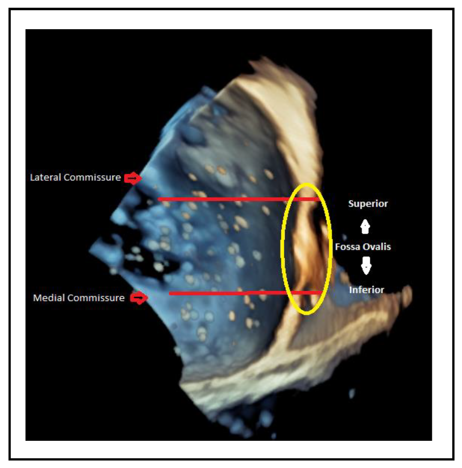 Preprints 161389 g014