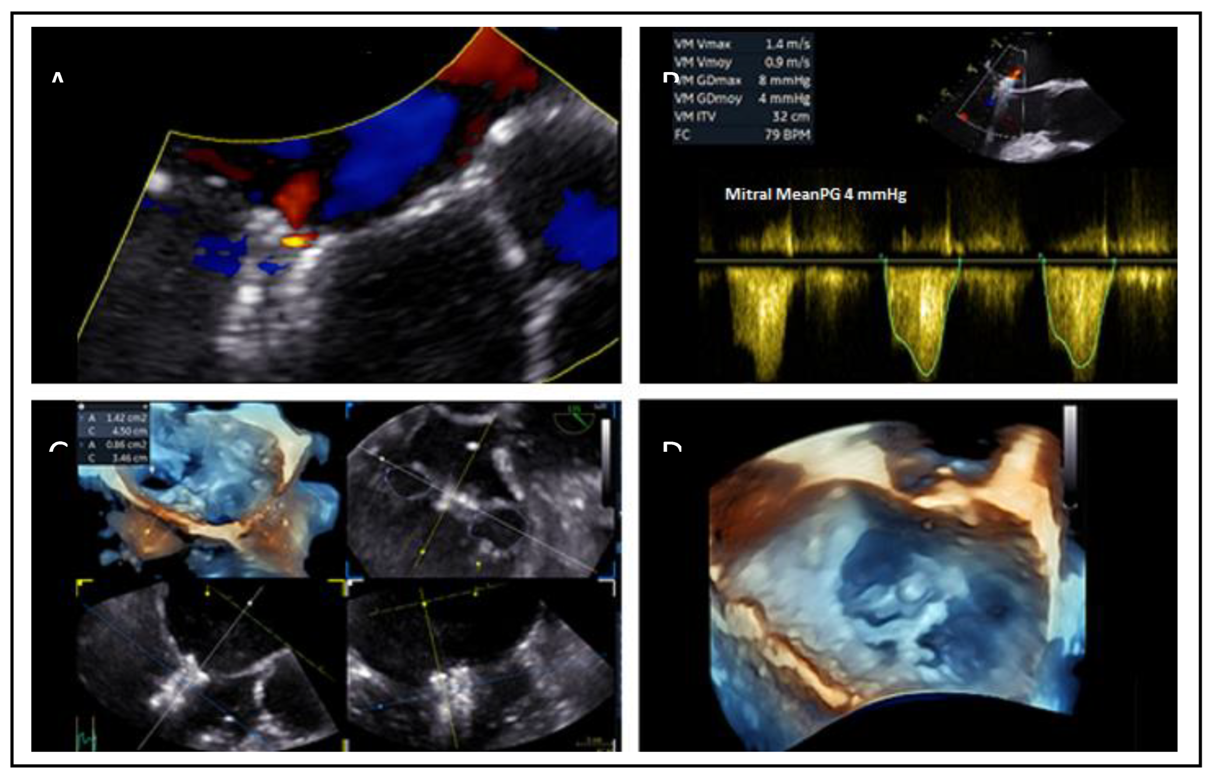 Preprints 161389 g020