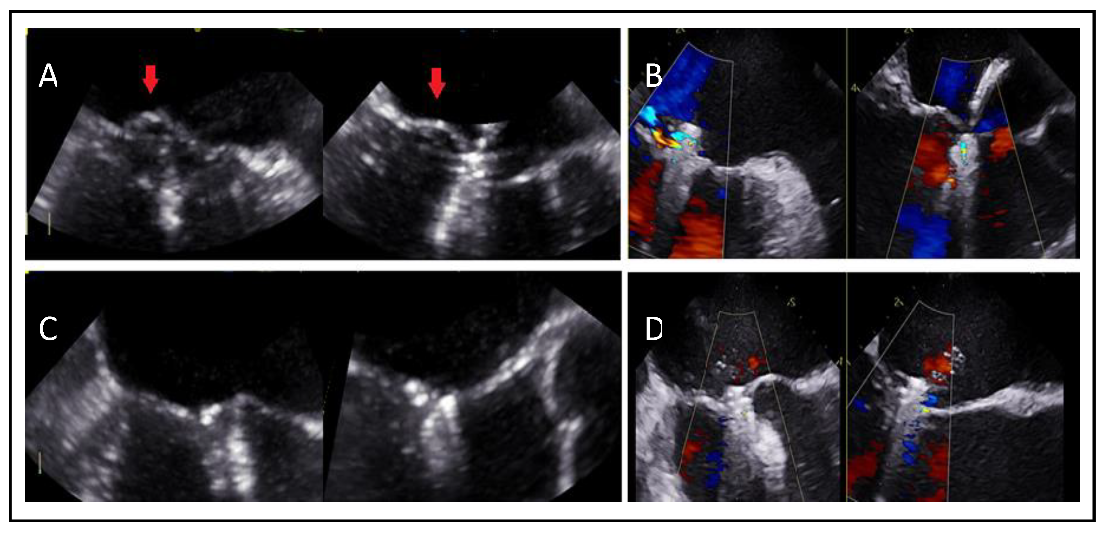 Preprints 161389 g021
