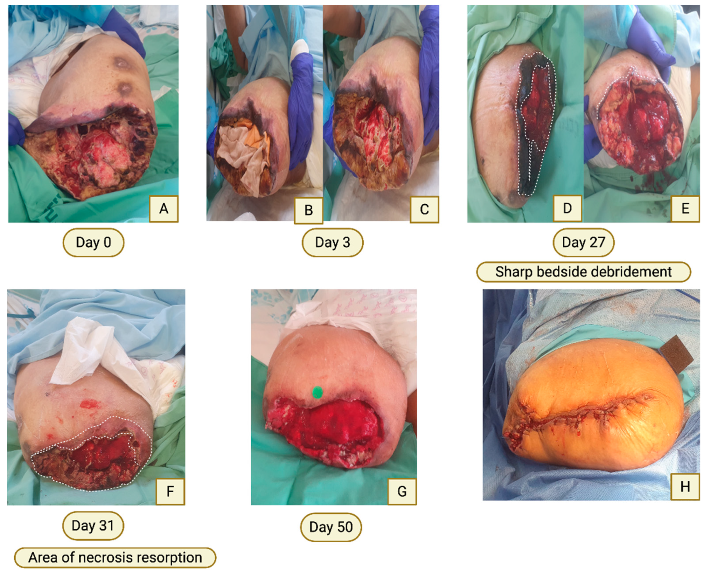 Preprints 197838 g002