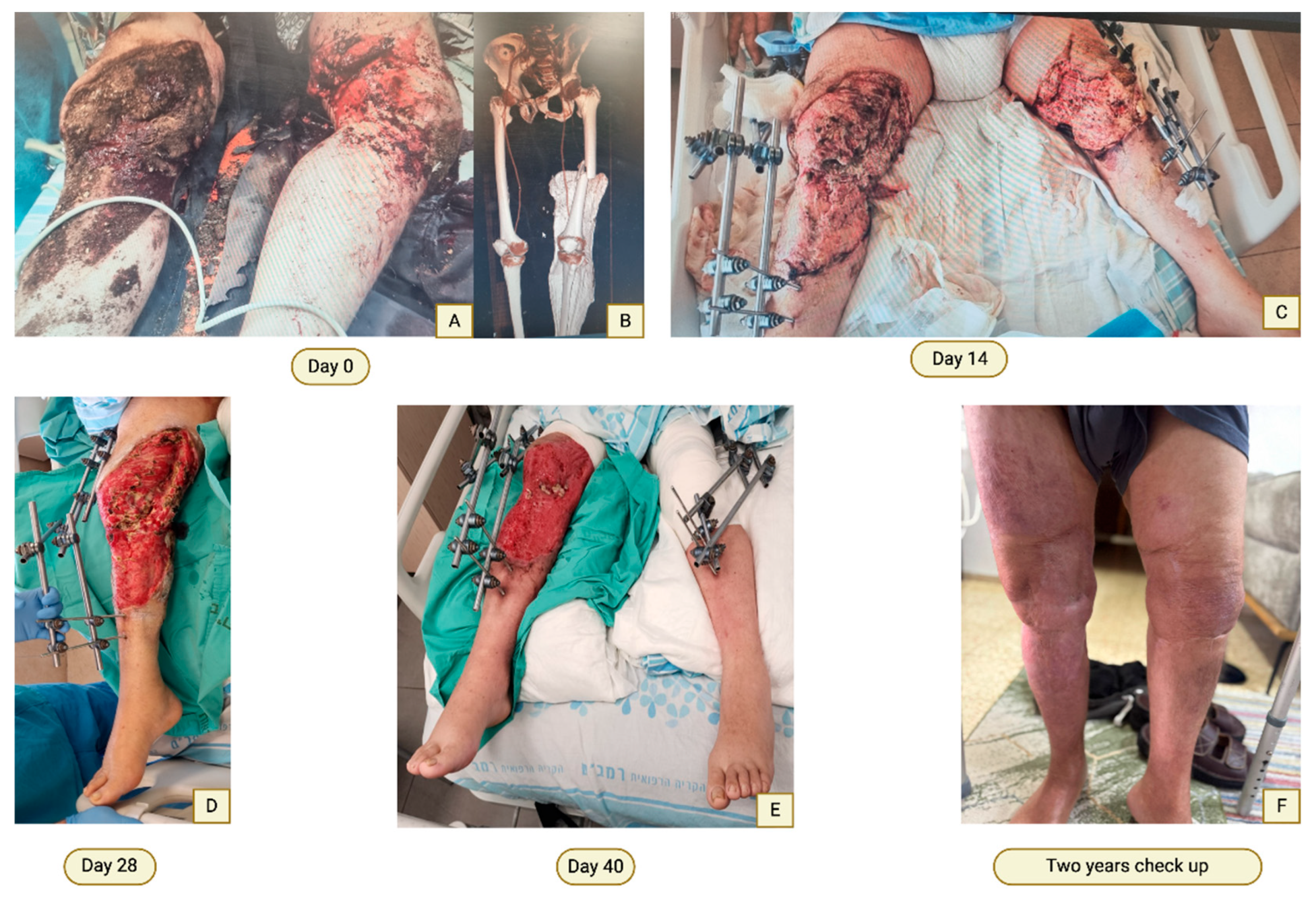 Preprints 197838 g005