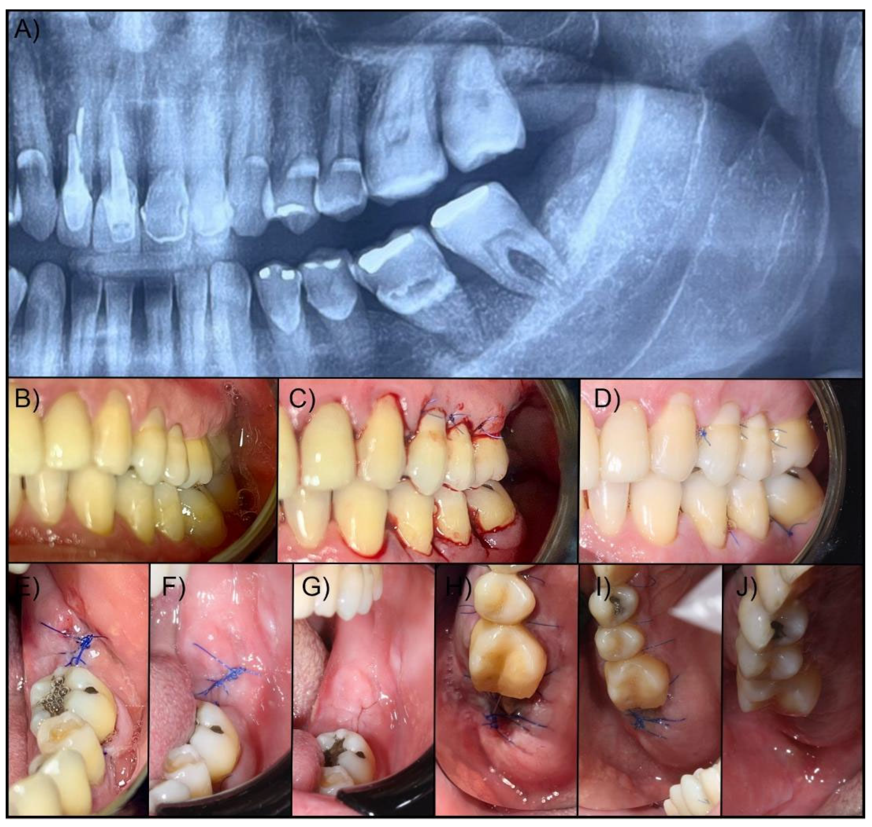 Preprints 155250 g001