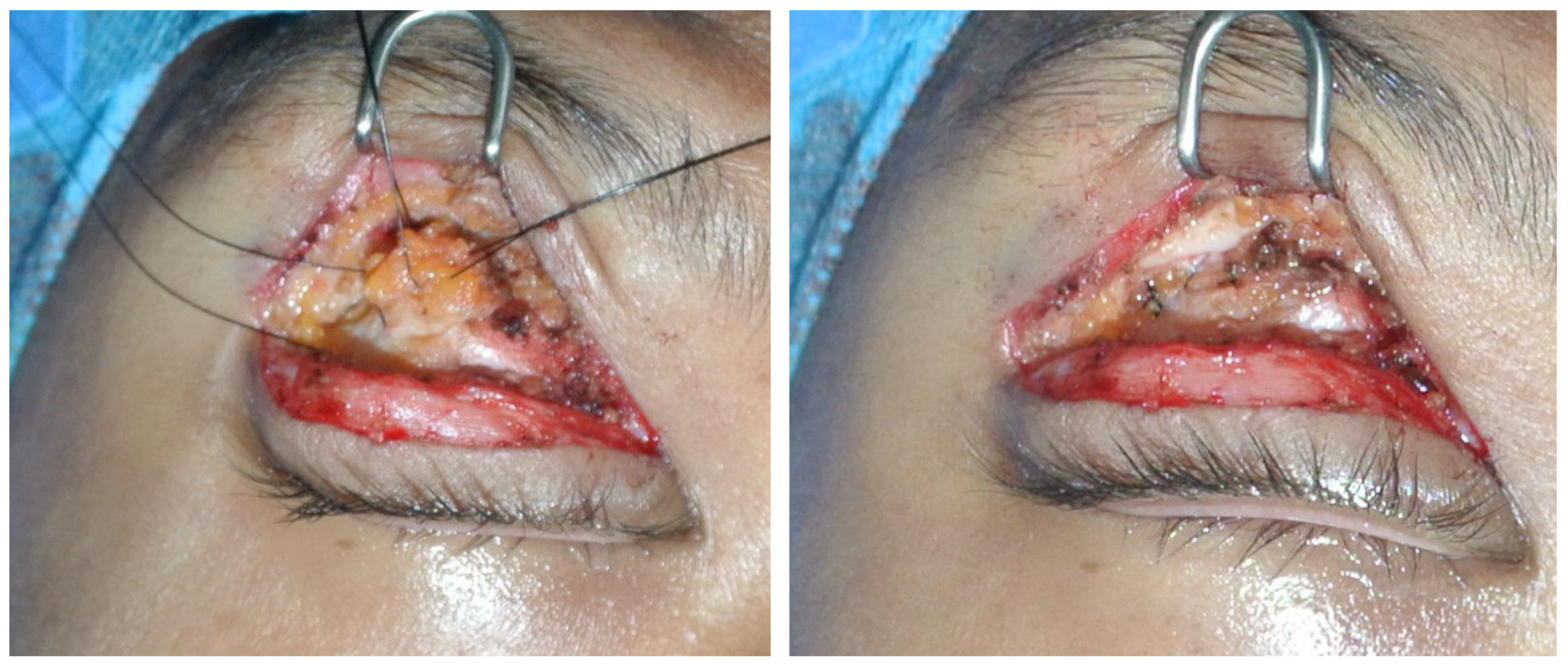 Preprints 68624 g005