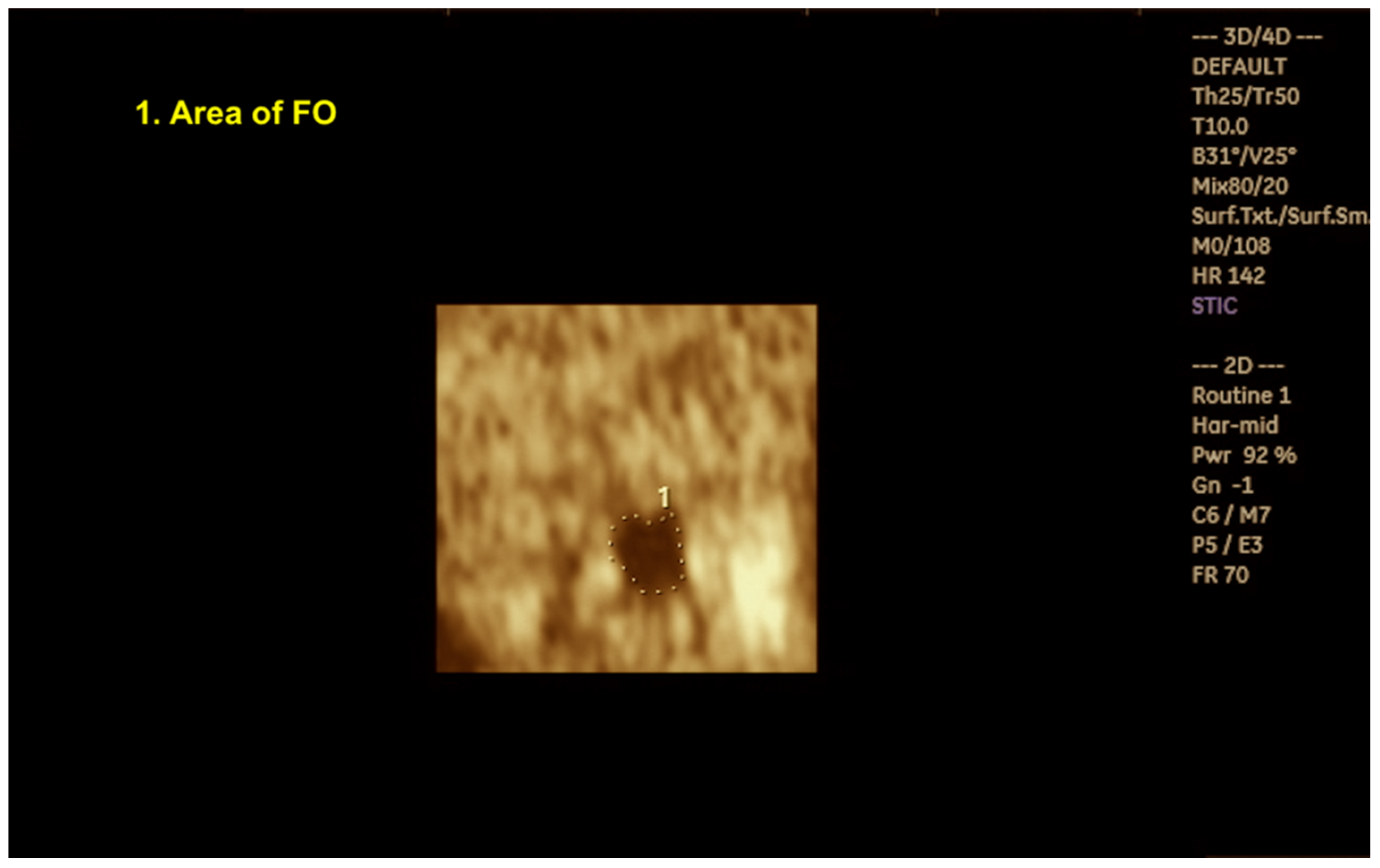 Preprints 138374 g013