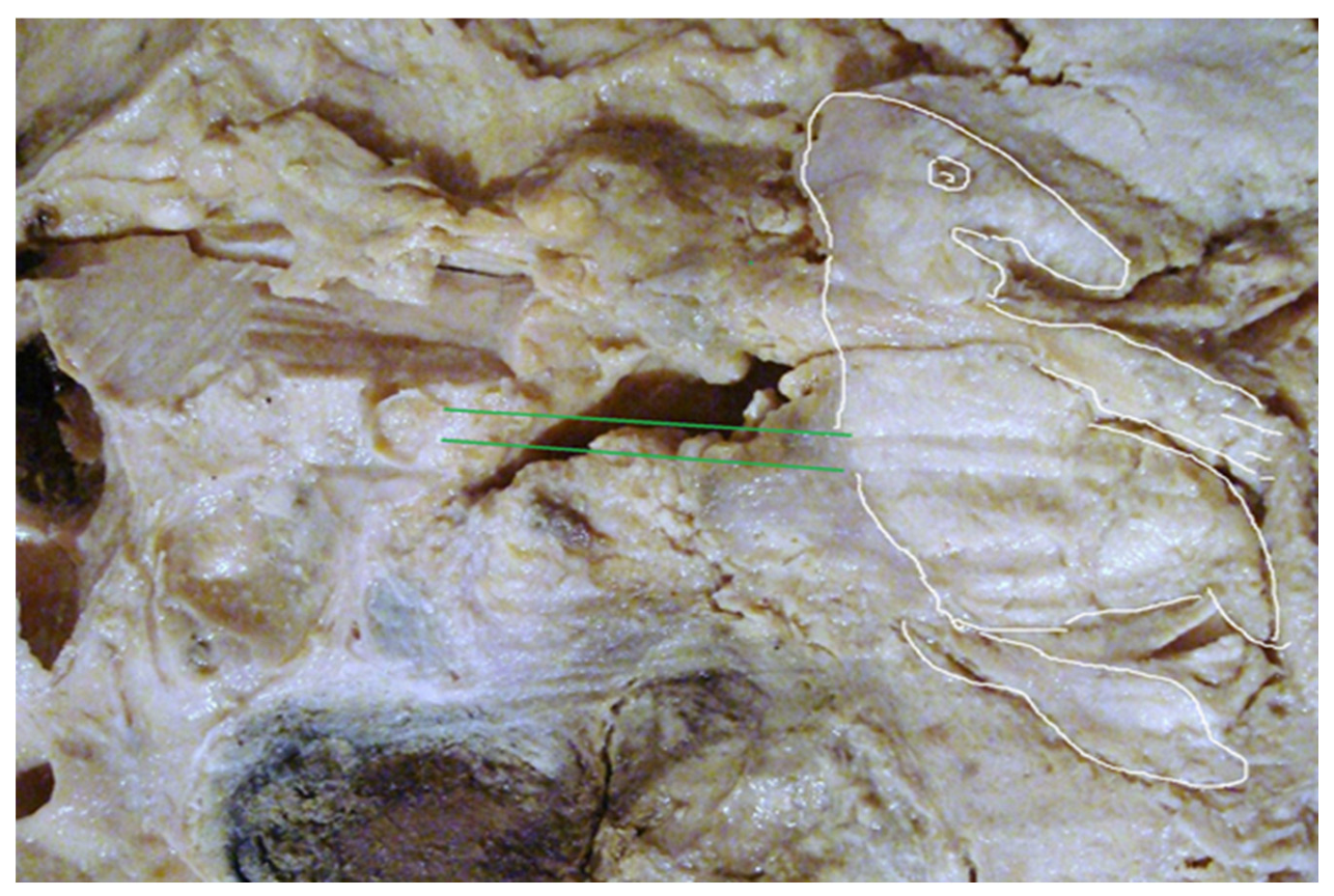 Preprints 117092 g019