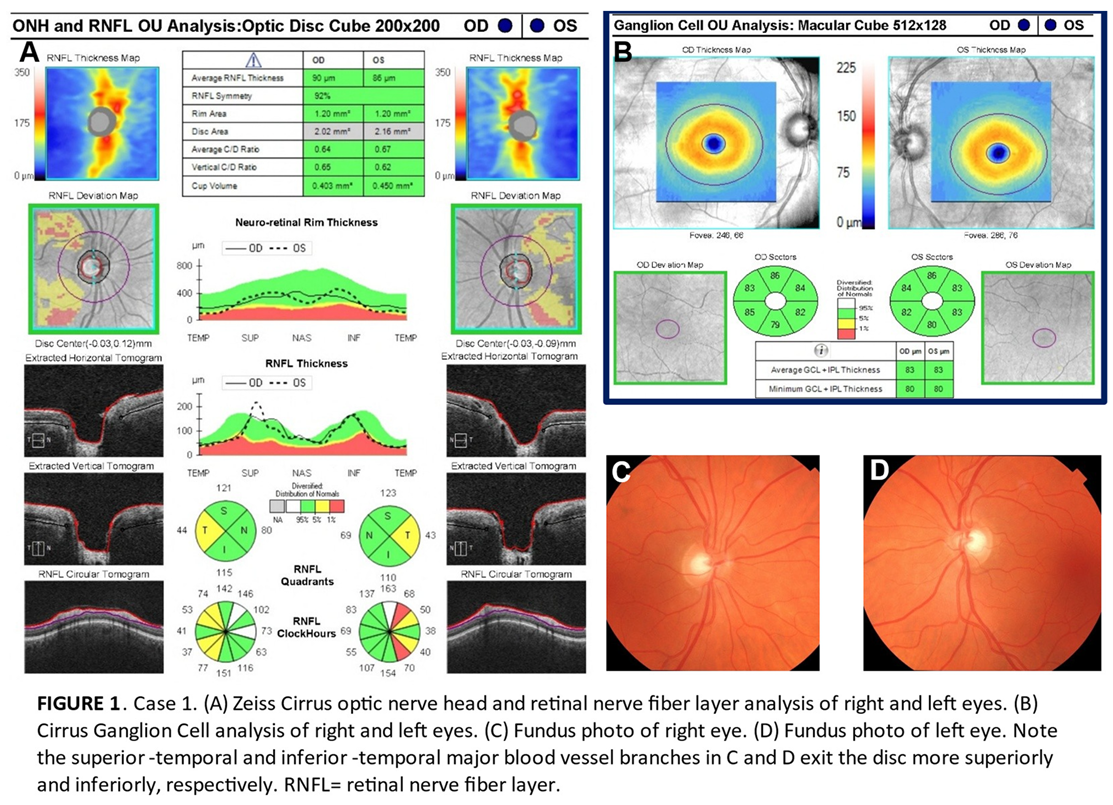 Preprints 155815 i001