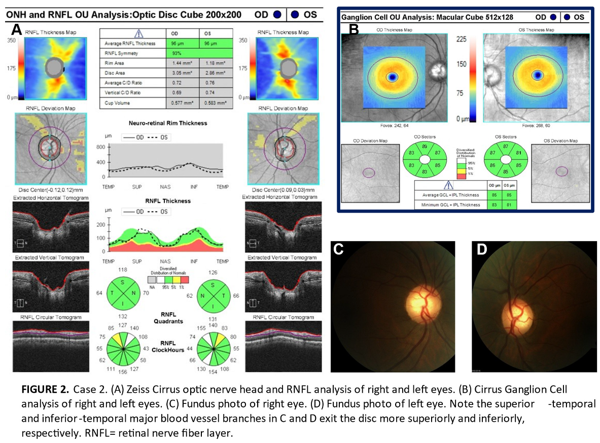 Preprints 155815 i002