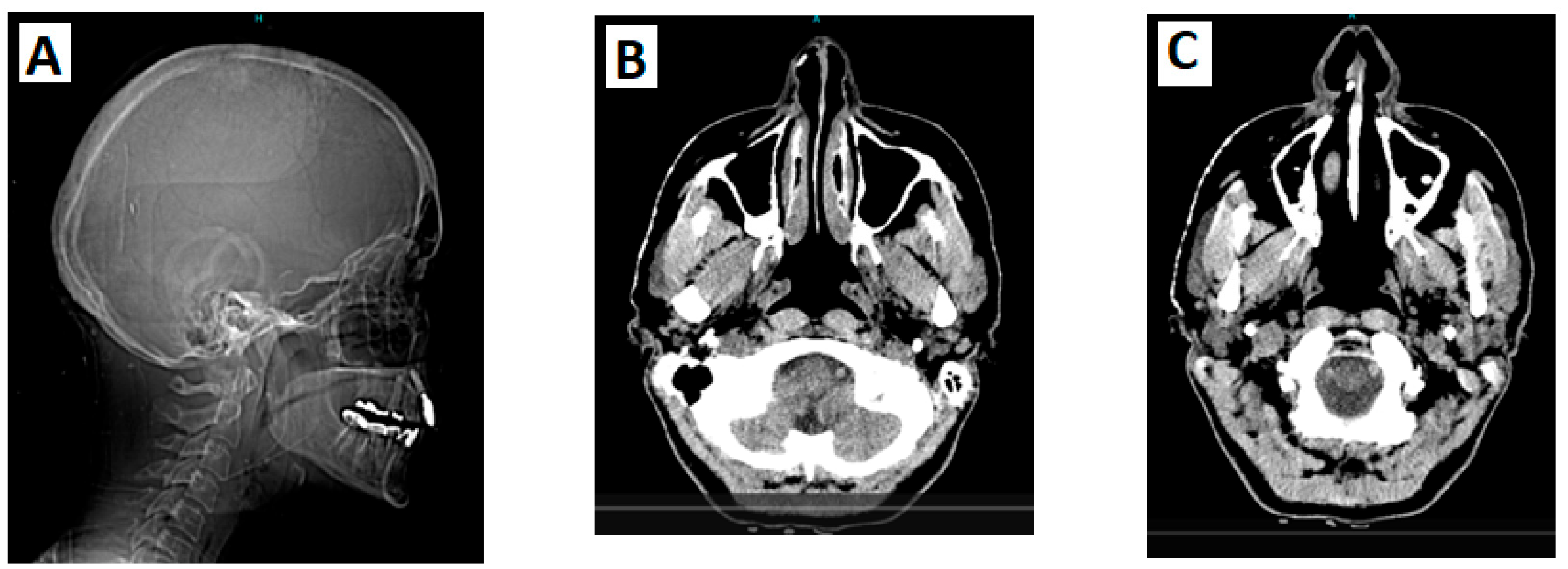 Preprints 166917 g002
