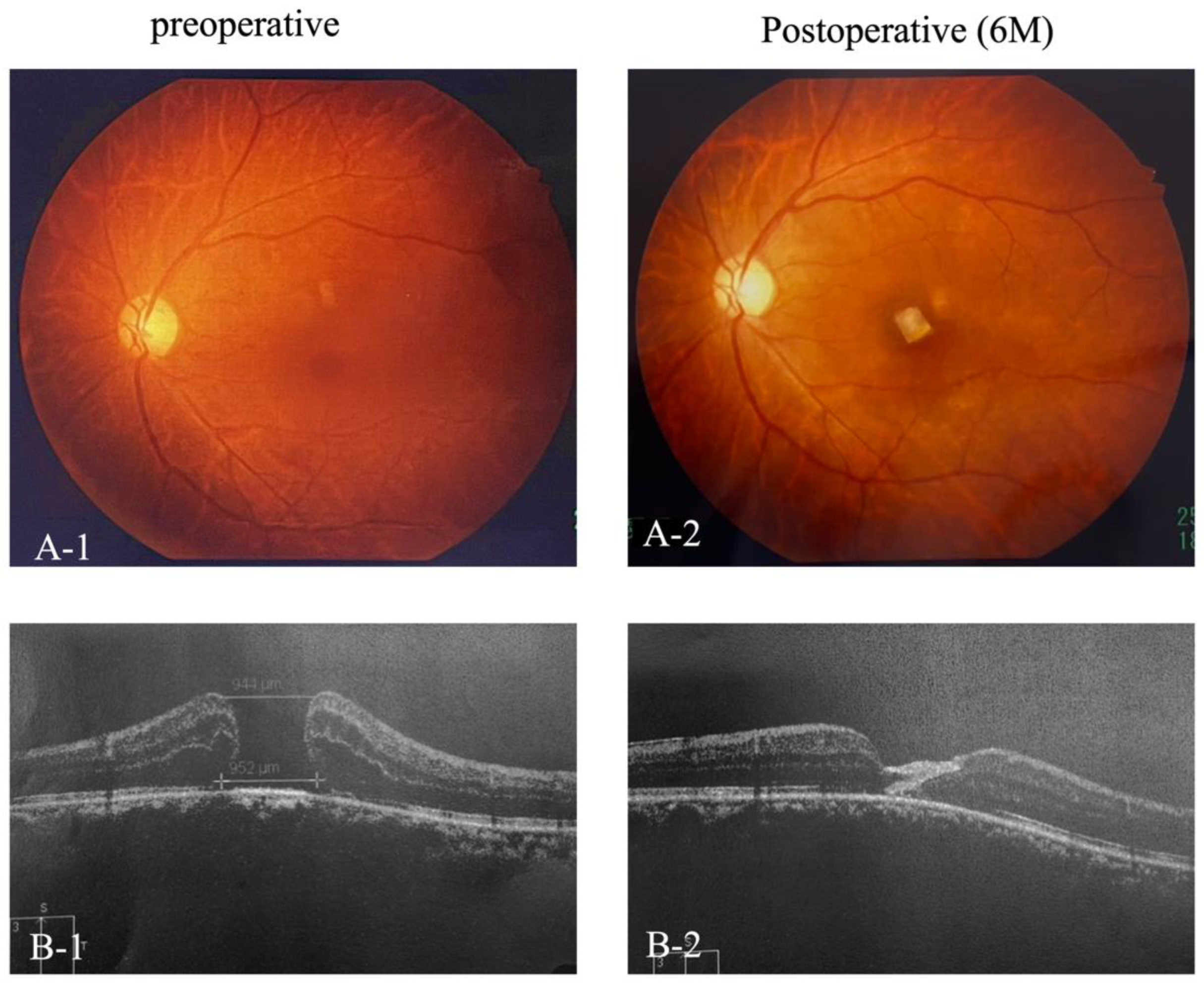 Preprints 158552 g001