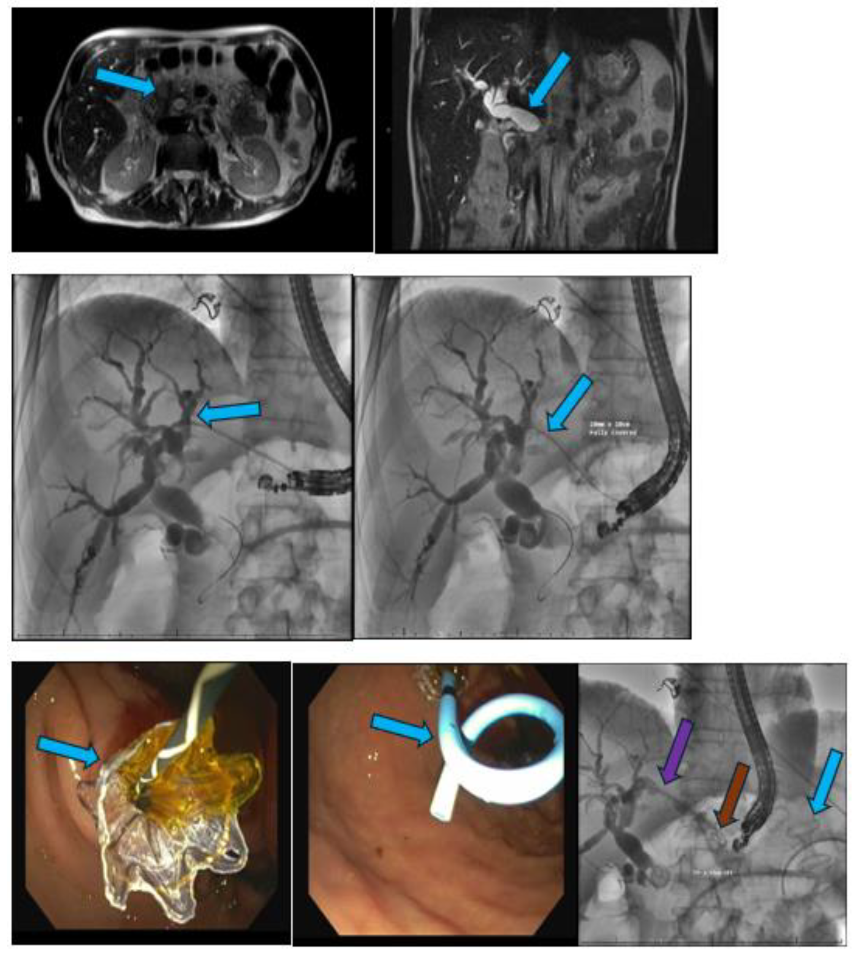 Preprints 140136 sch003