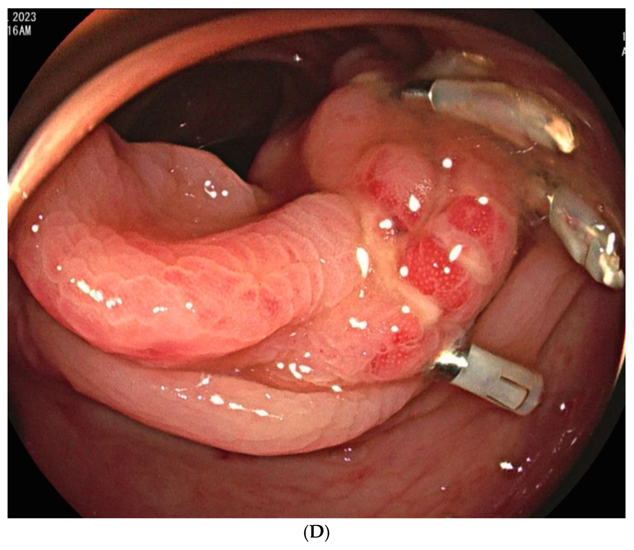 Preprints 172251 g003c
