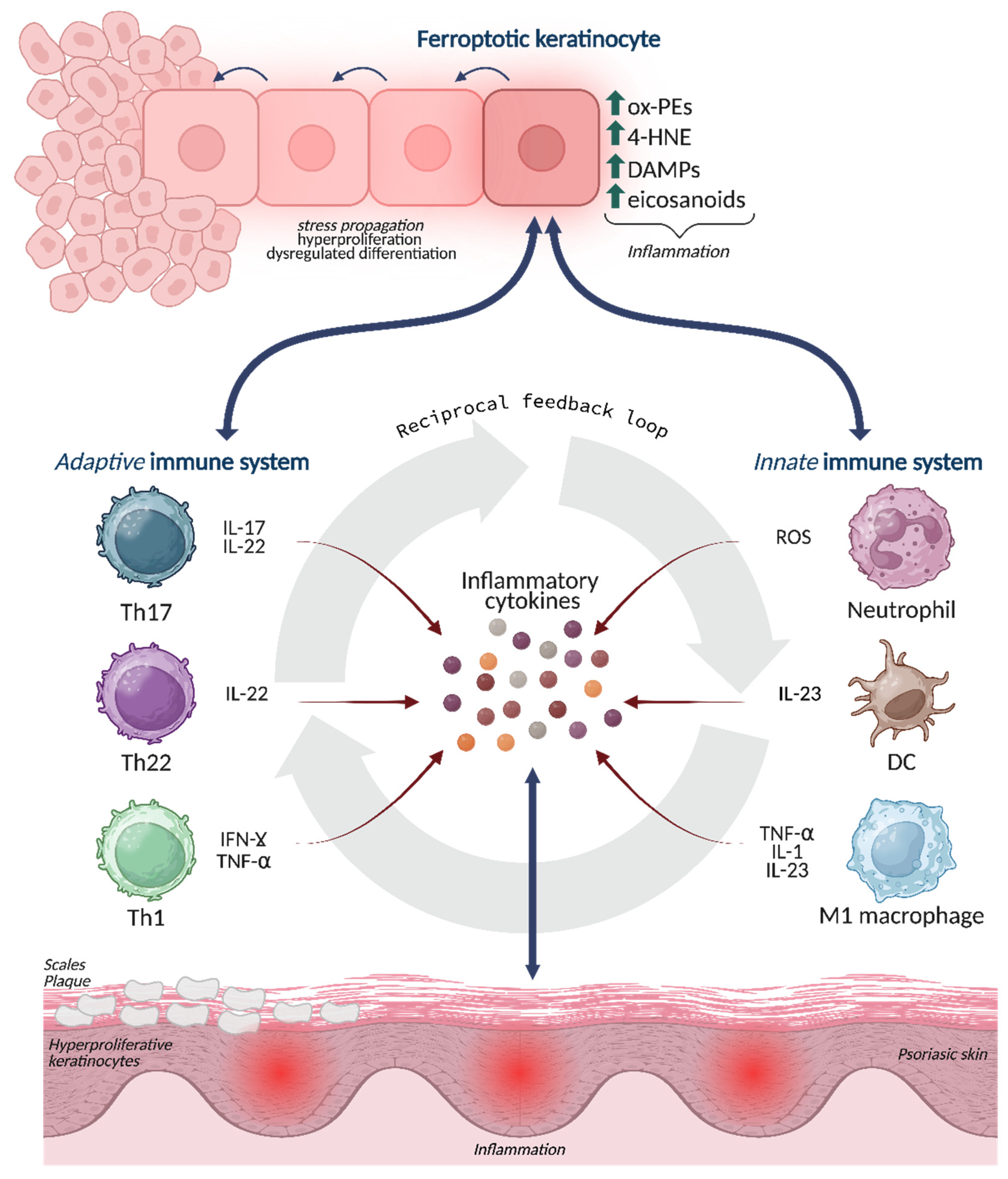 When and How Ferroptosis Becomes Pathogenetic in Psoriasis[v1]