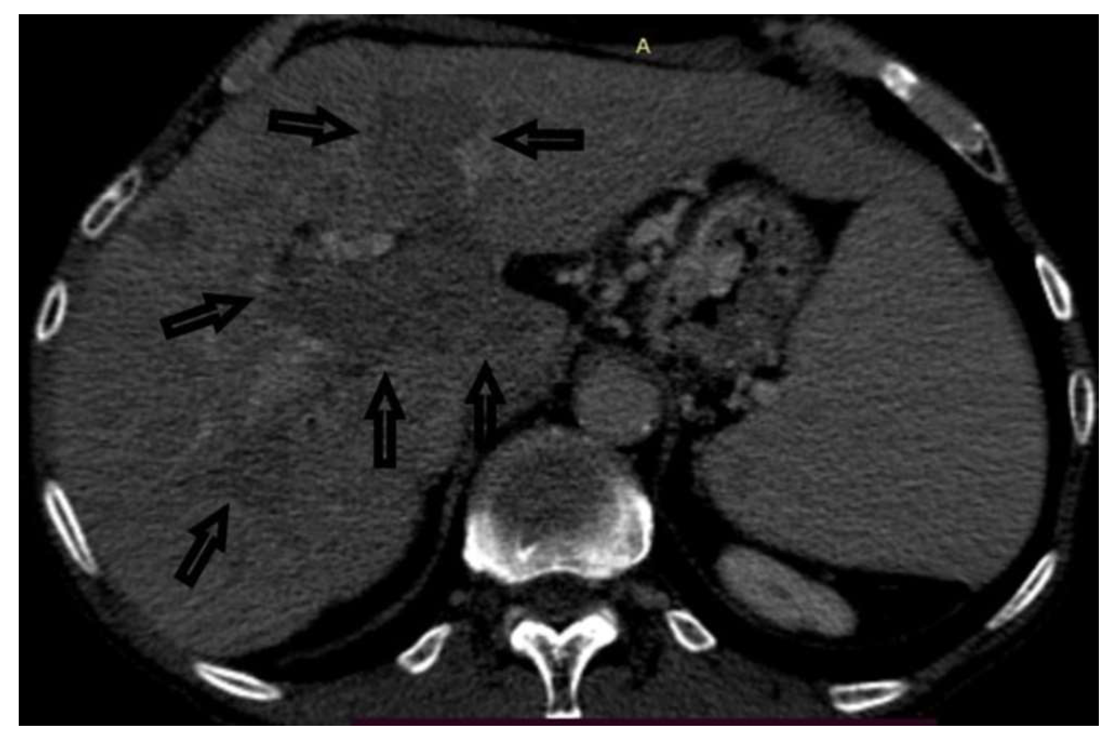Preprints 153053 g005