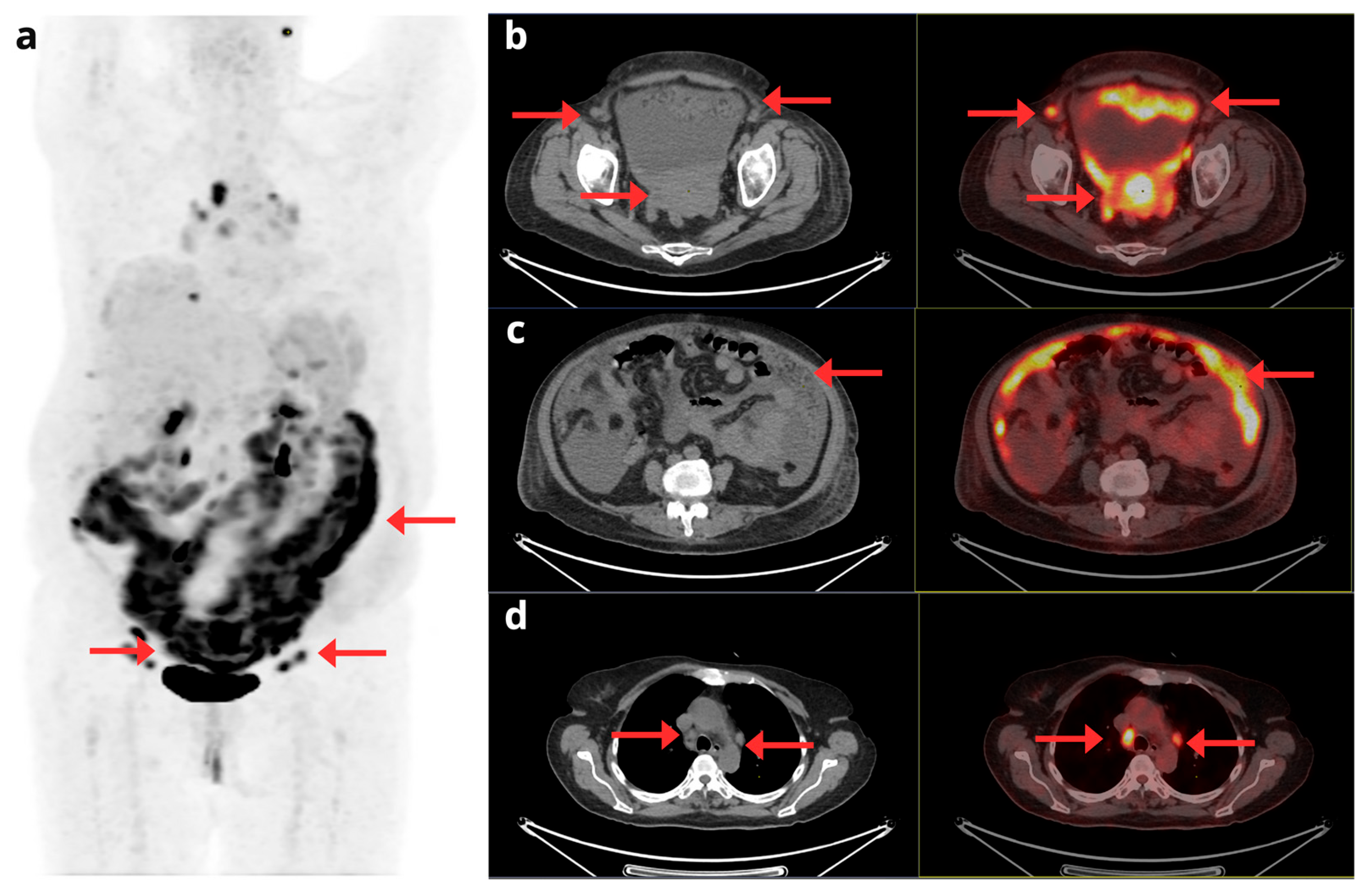 Preprints 164229 g003
