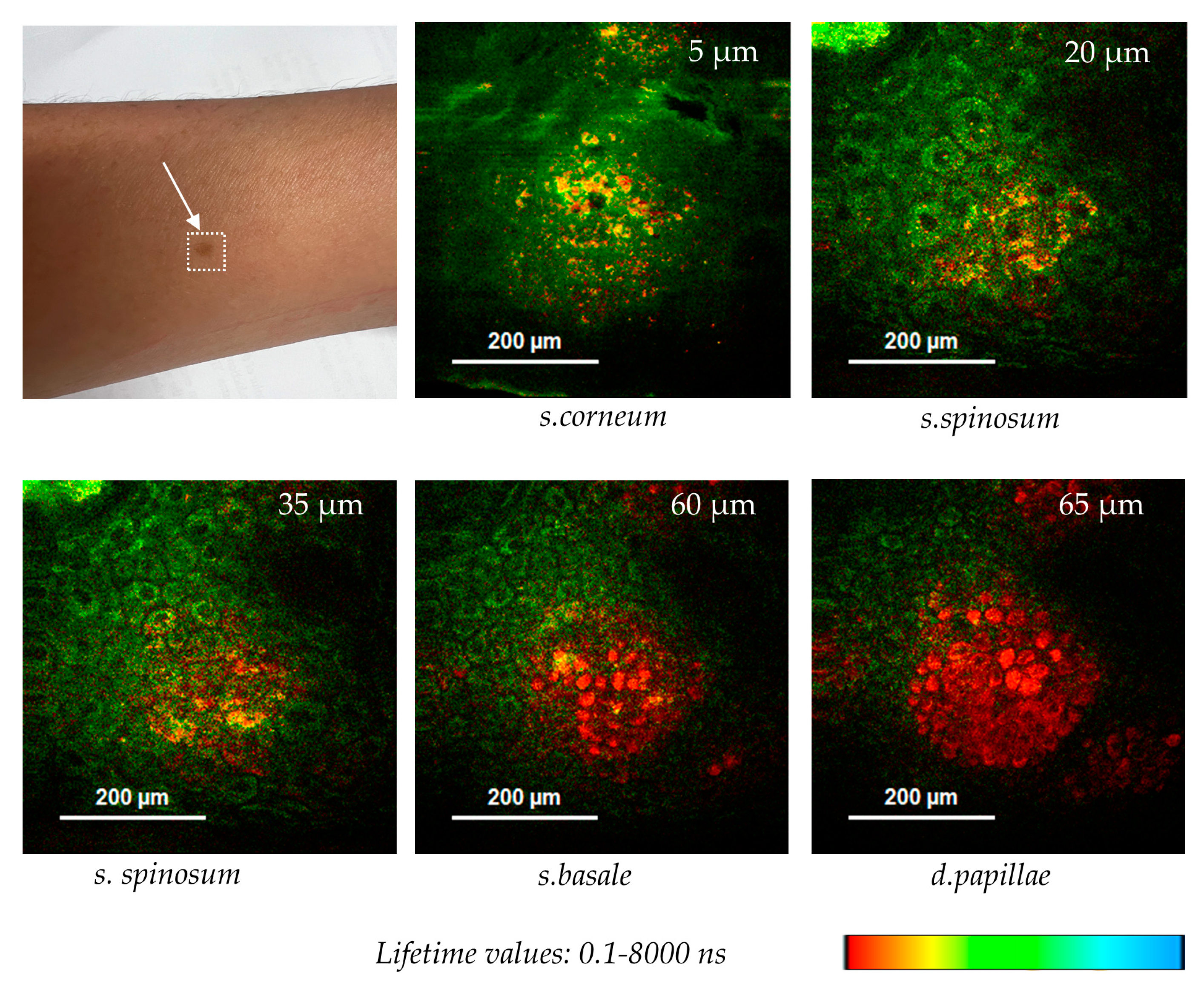 Preprints 144022 g011