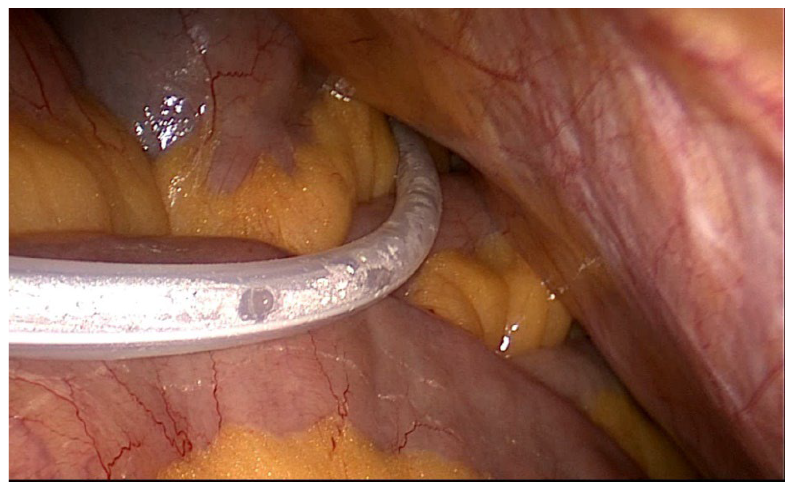 Preprints 107597 i001