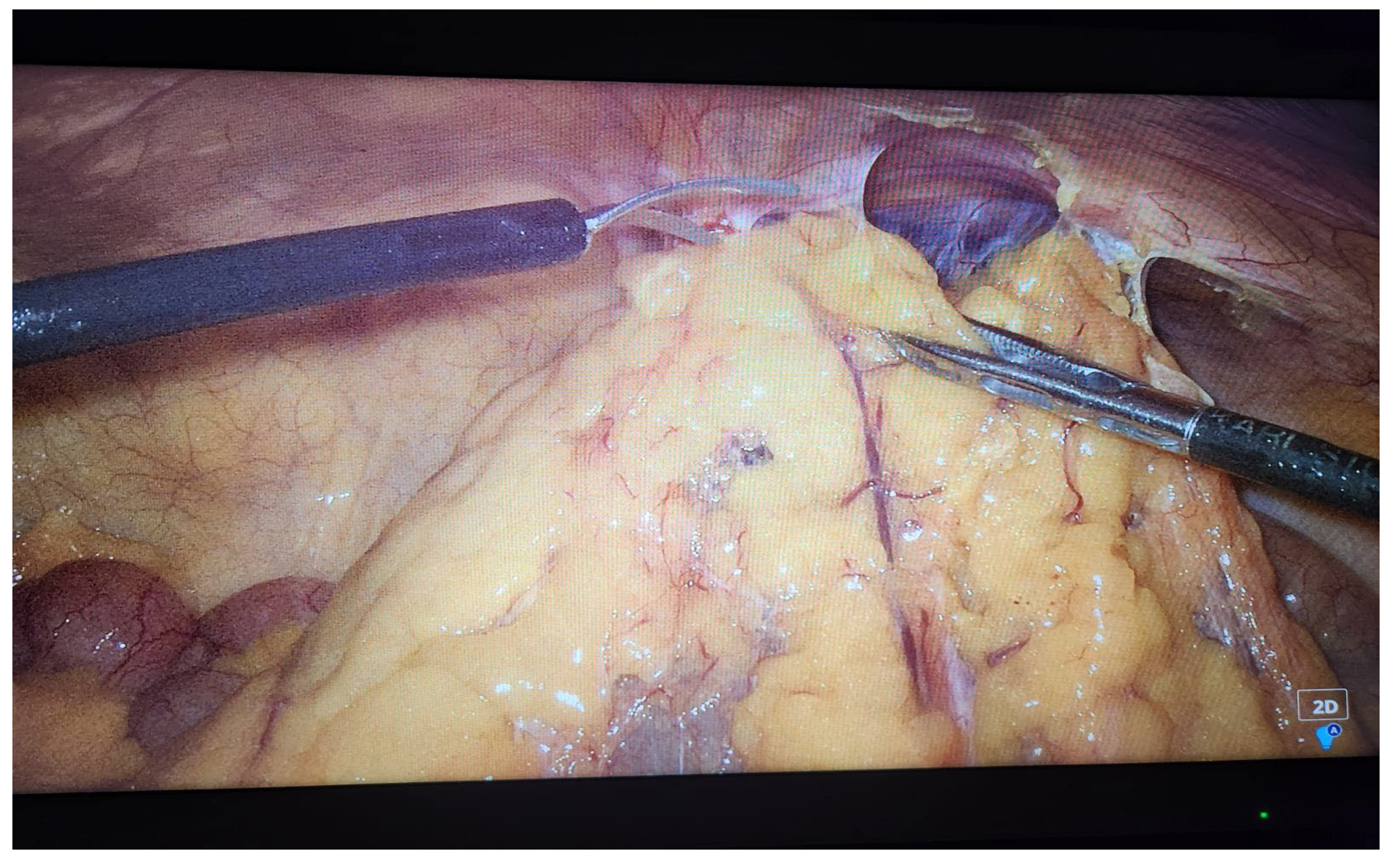 Preprints 107597 i002