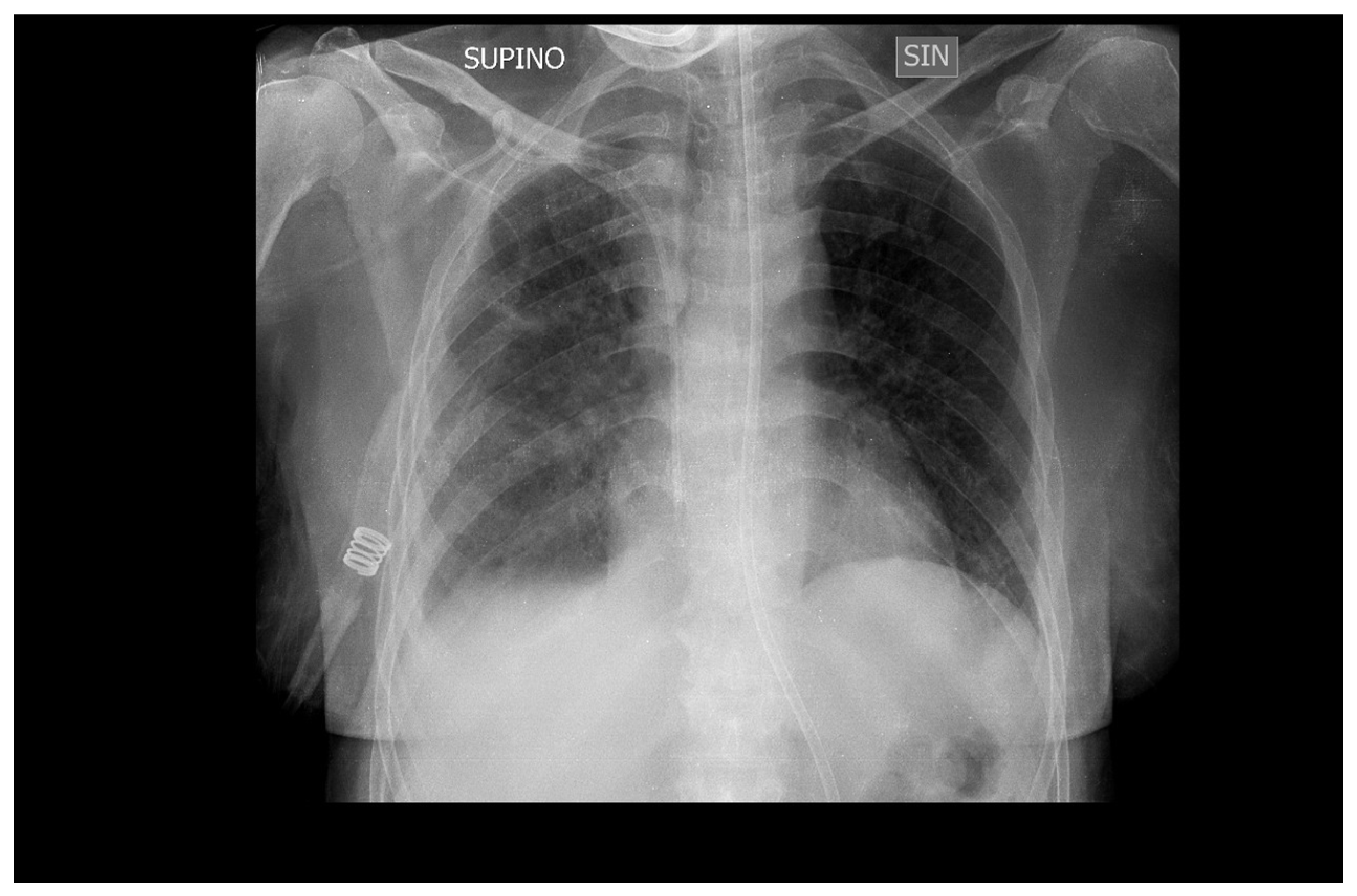 Preprints 92500 g004