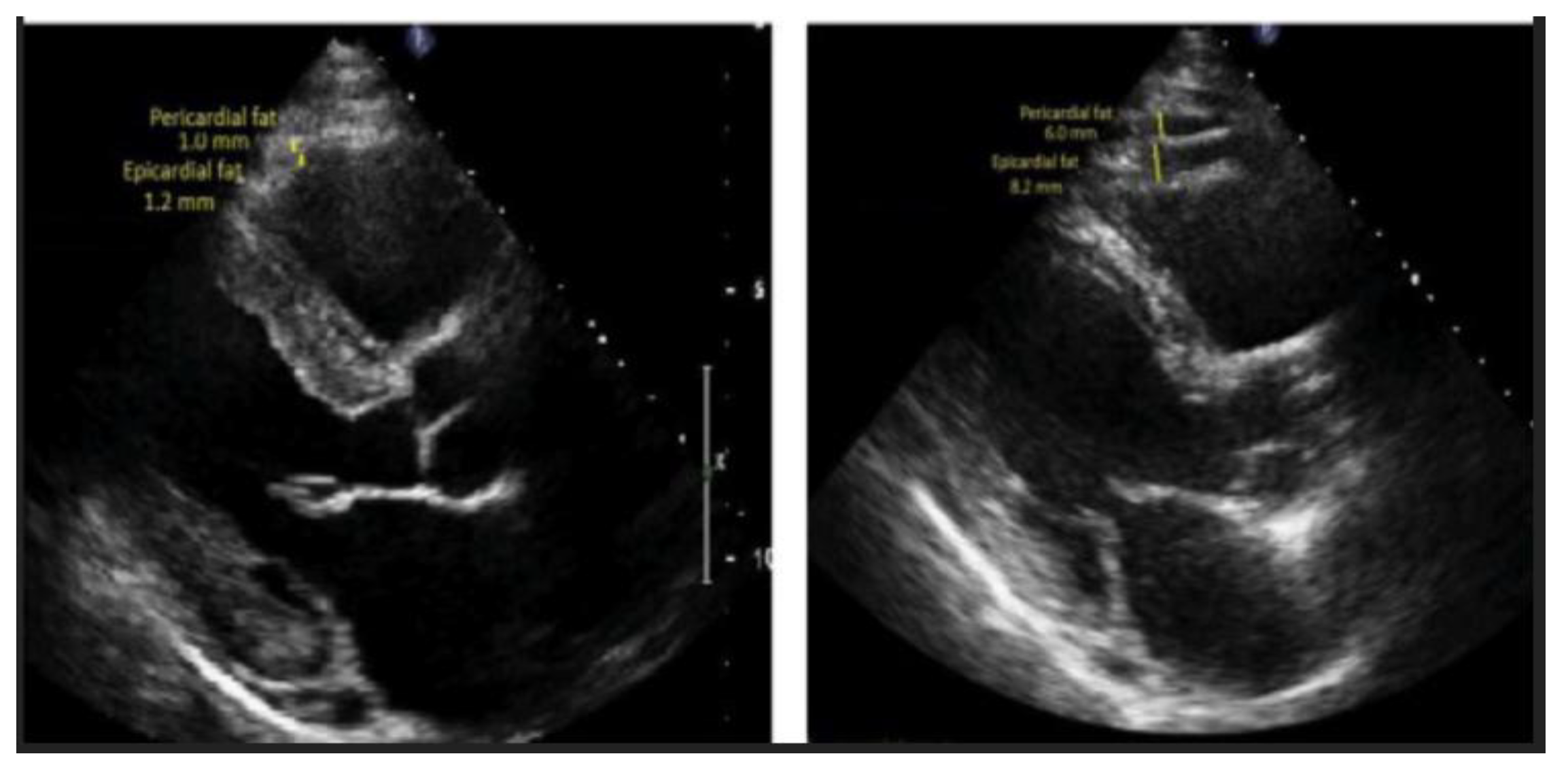 Preprints 152516 g014b