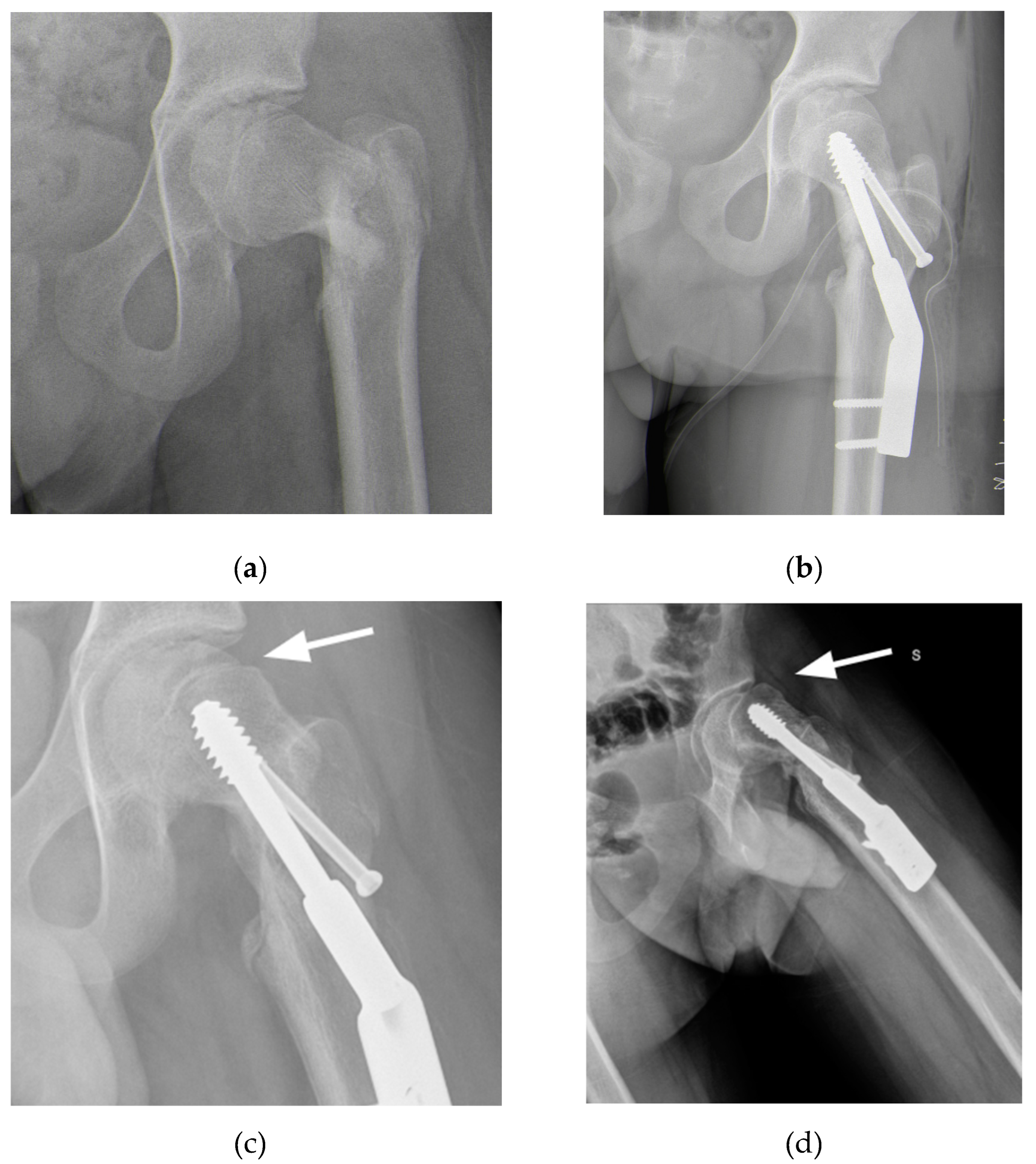 Preprints 141437 g001