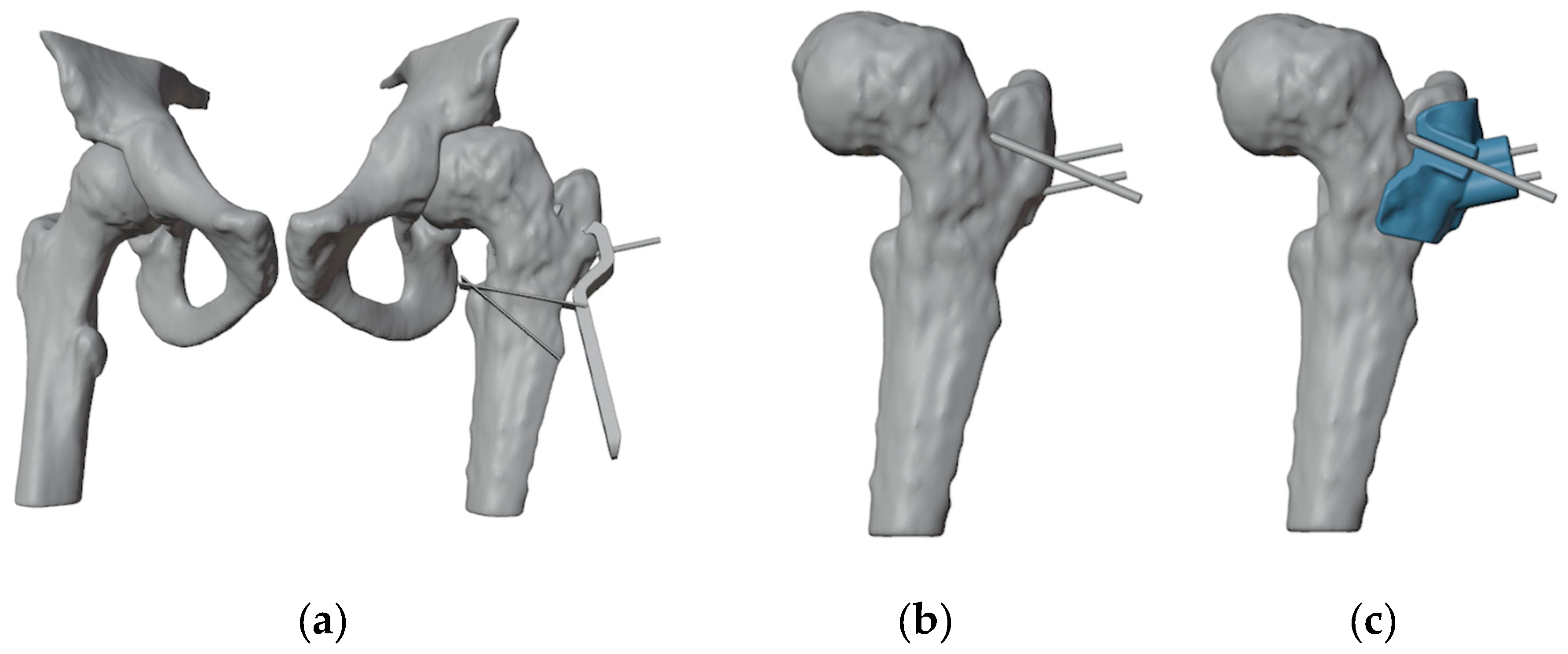 Preprints 141437 g004