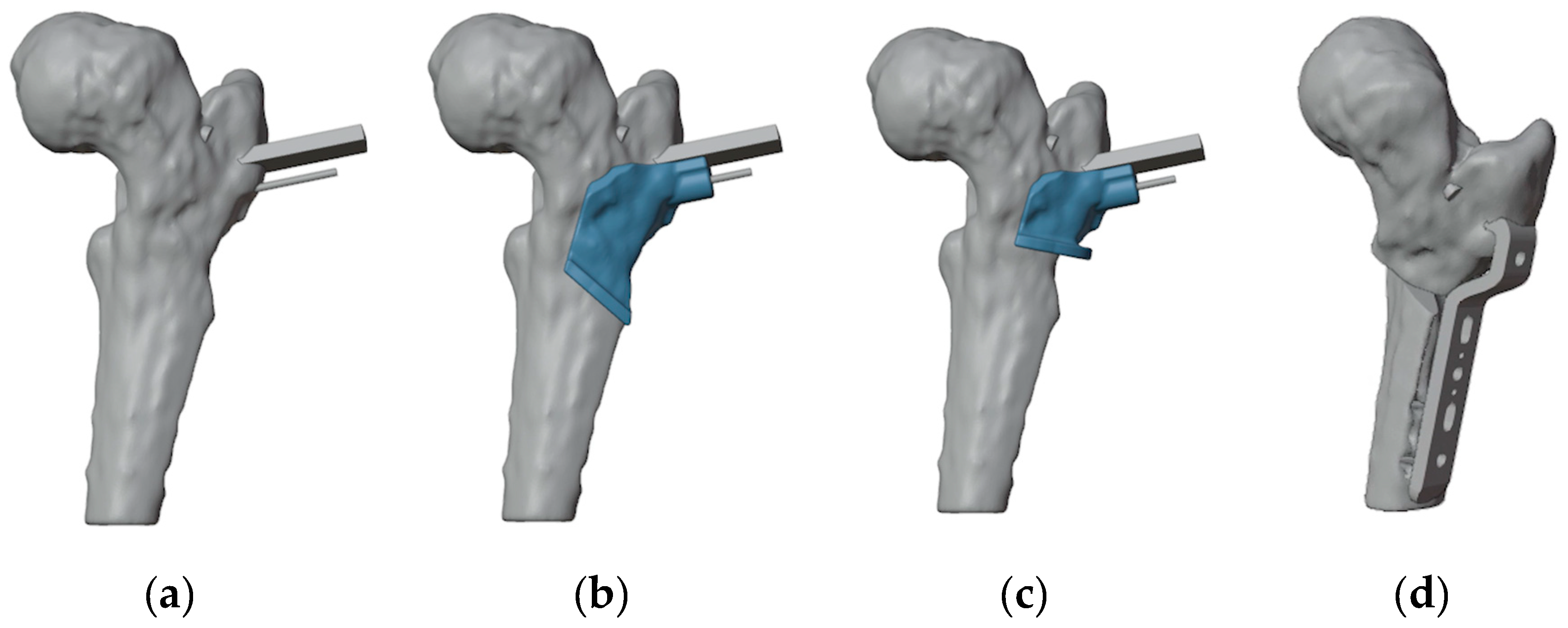 Preprints 141437 g005