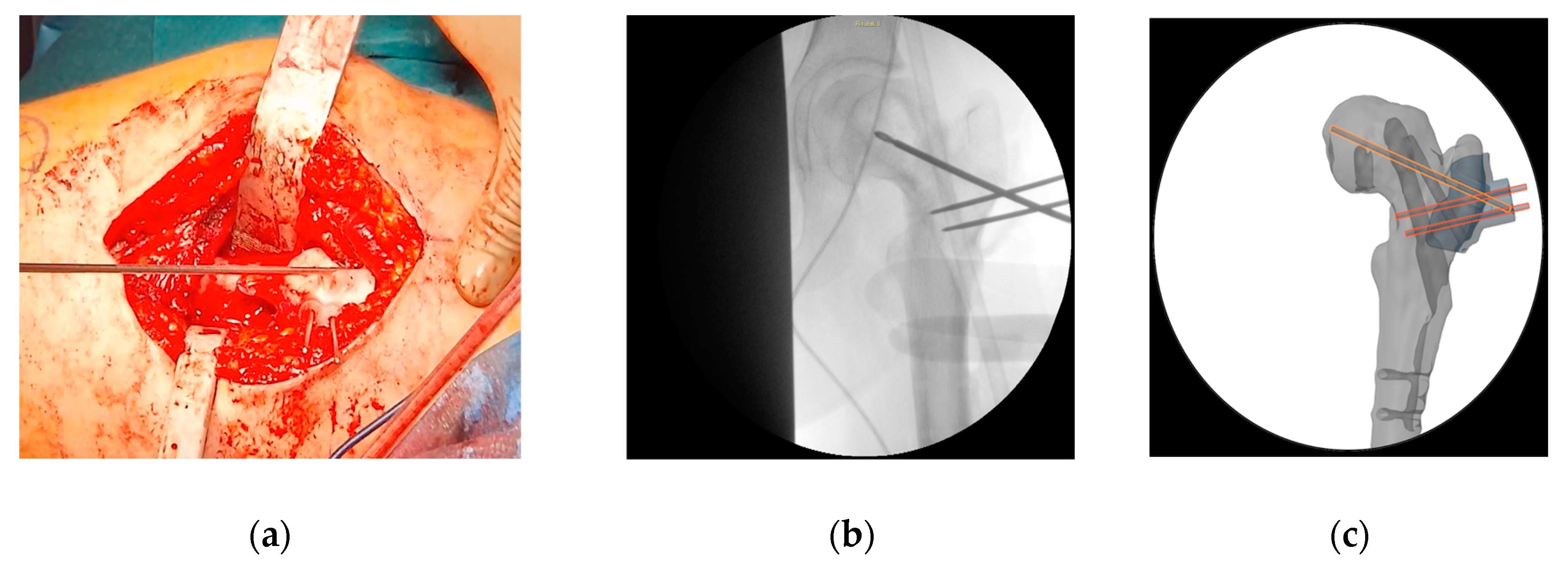 Preprints 141437 g006