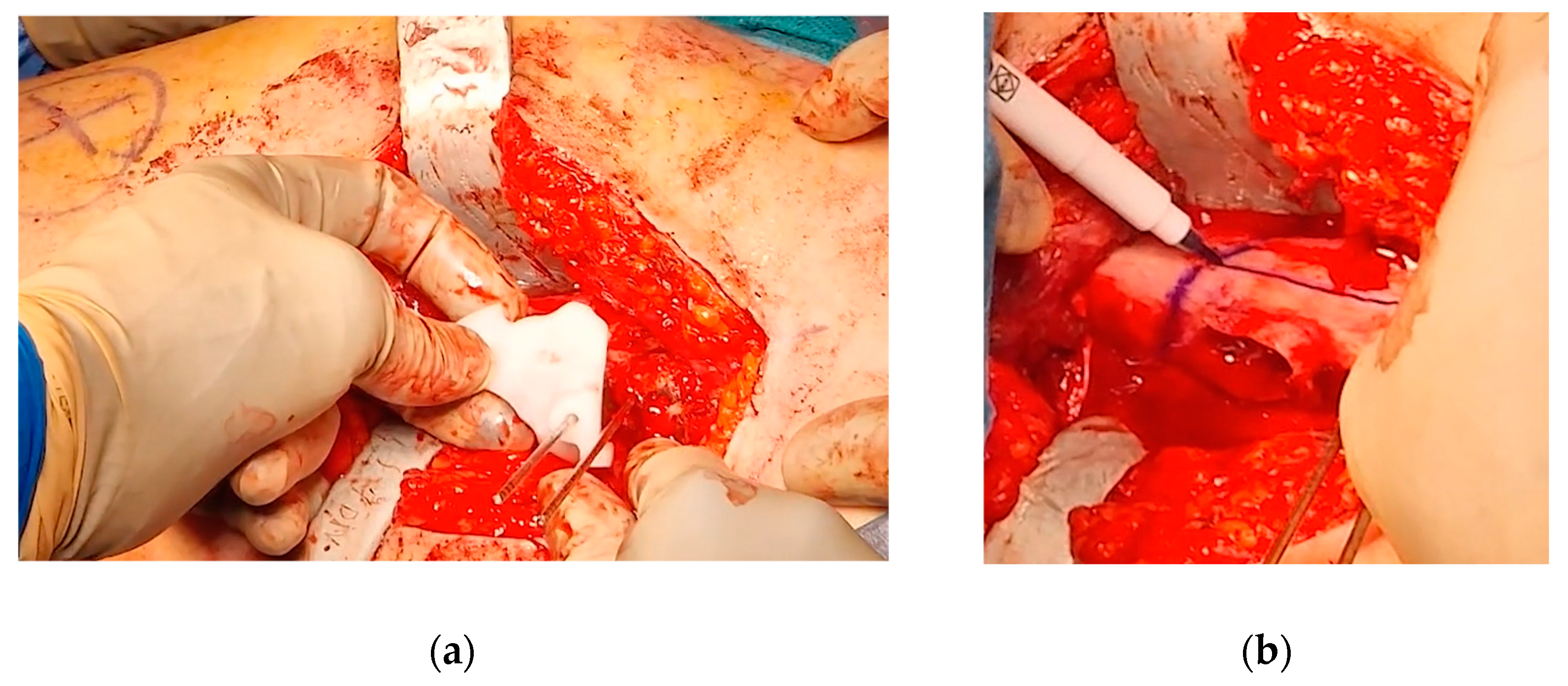 Preprints 141437 g007